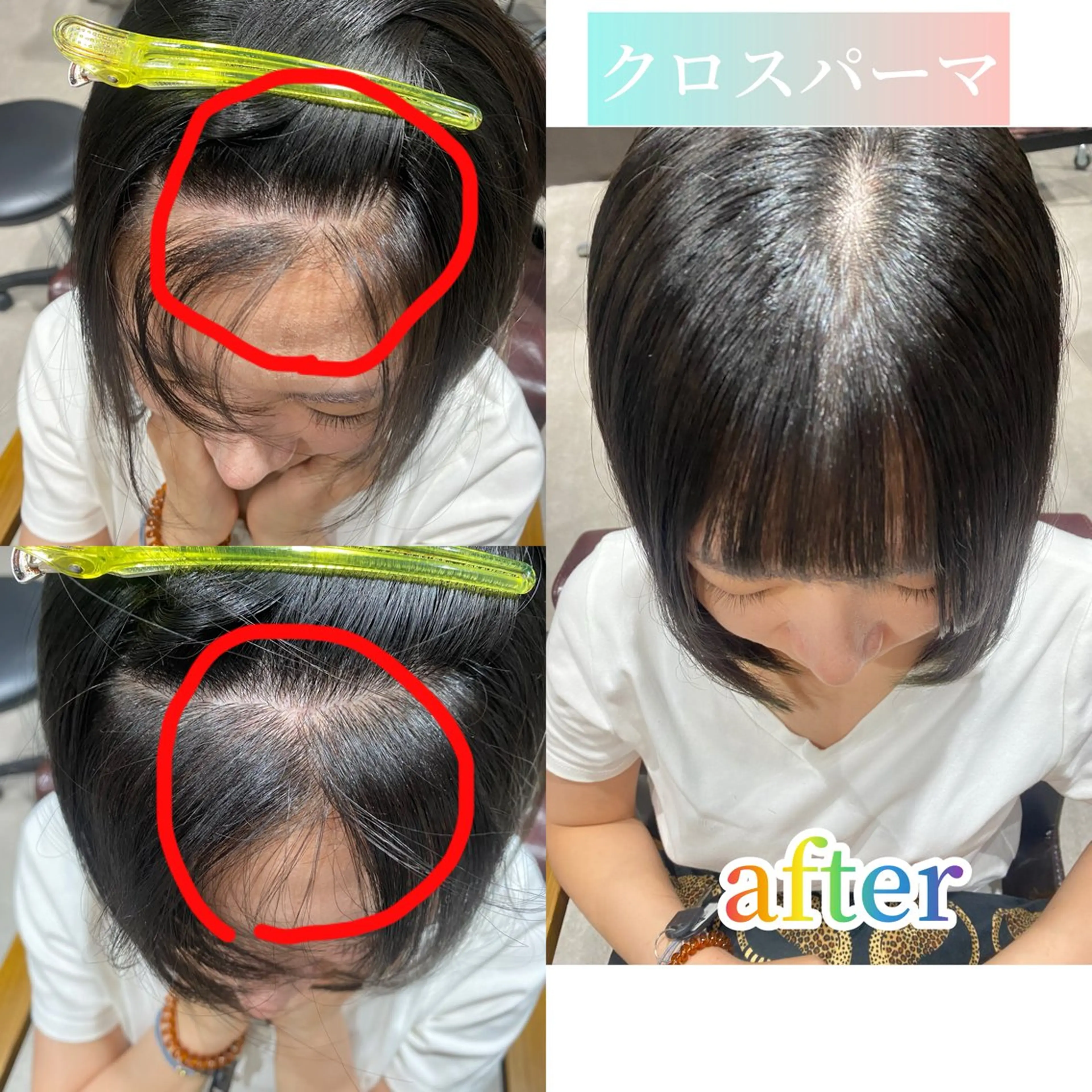 🌈韓国発祥🇰🇷クロスパーマ✨✨🌈前髪生えぐせ、割れ癖改善して下ろせる前髪に⭐️カット、シャンプーブロー込み。の写真