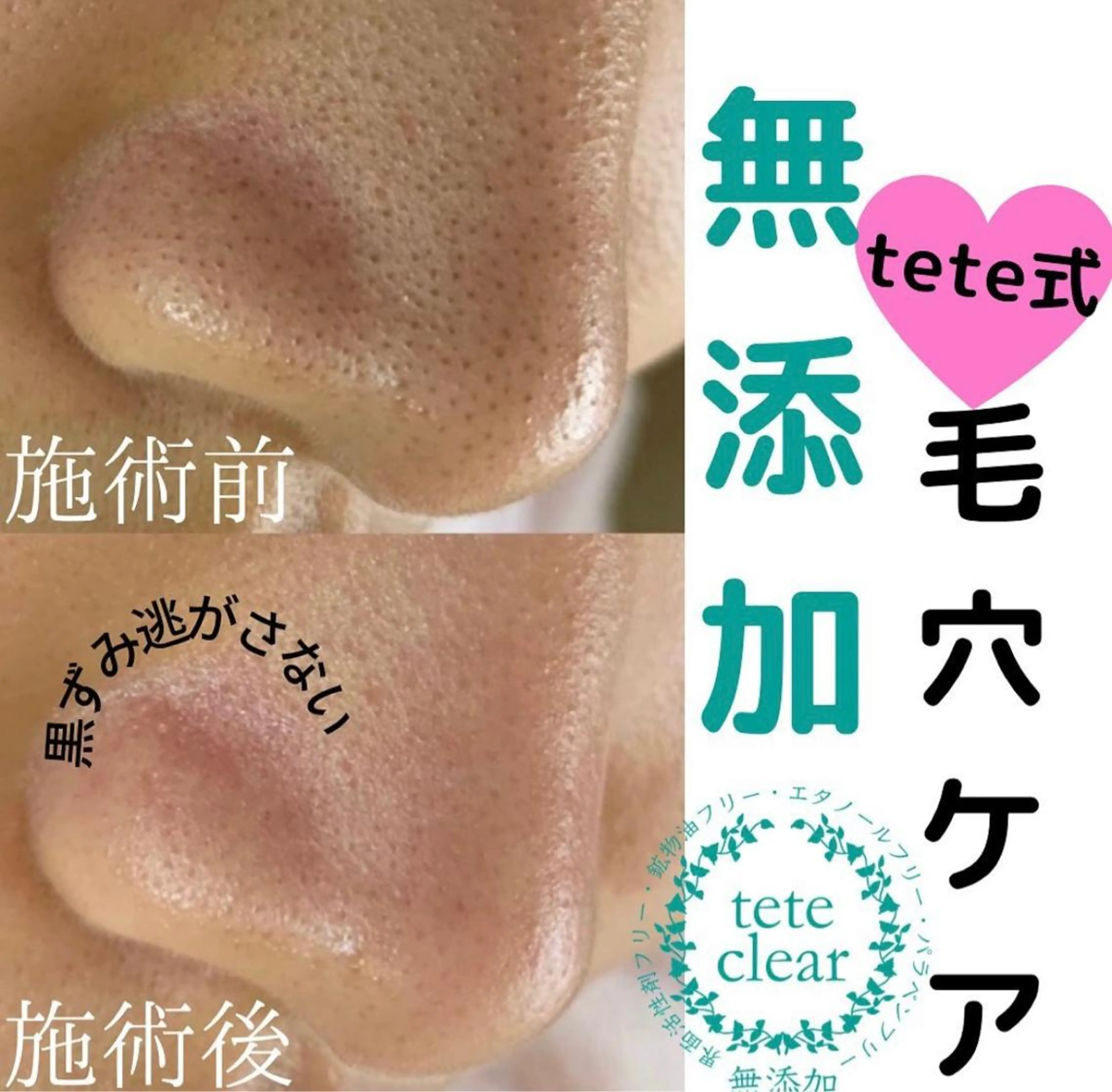 Monreve所属・Monreve 🌿のエステ・リラクイメージ