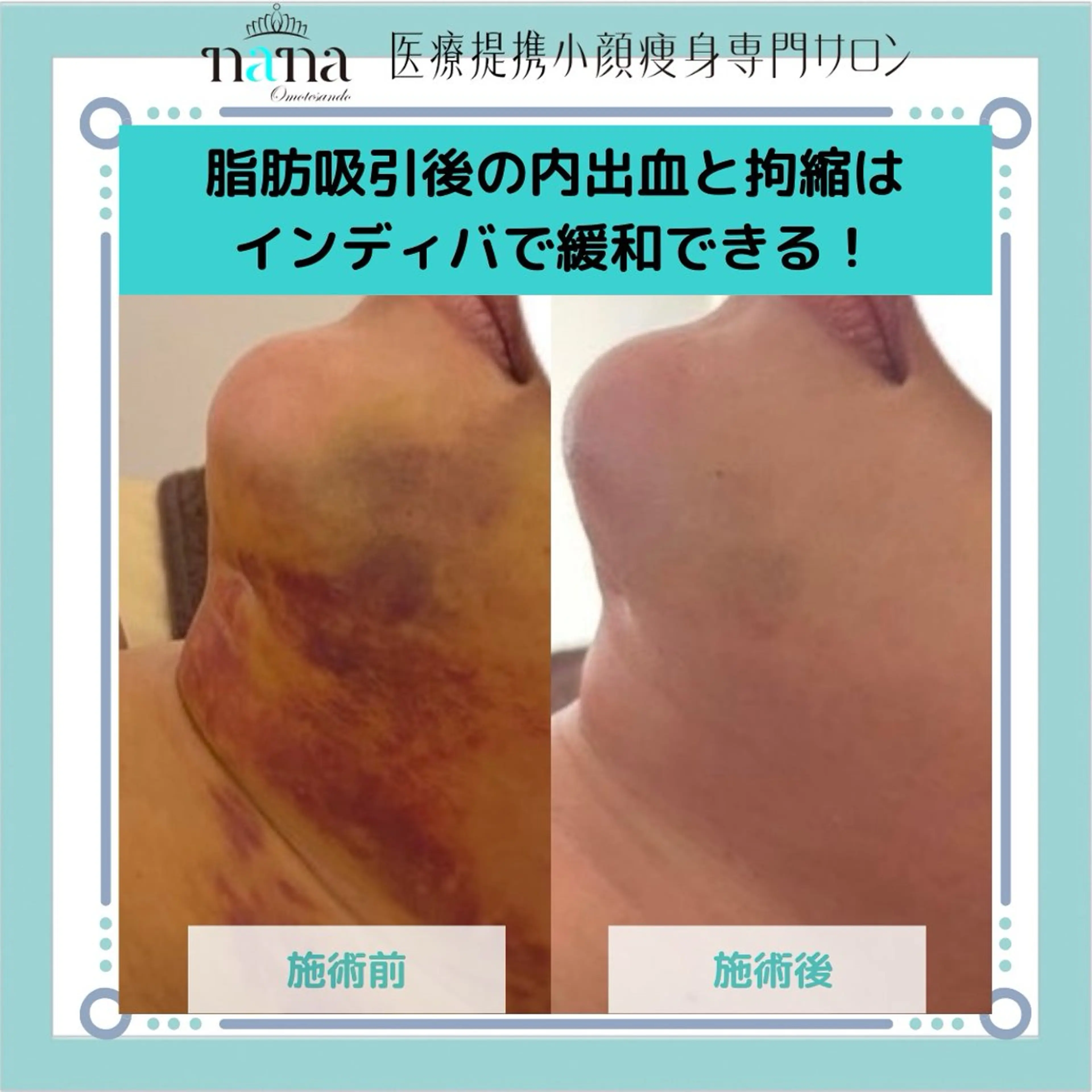 エステ リラク 小顔痩身インディバ Nana表参道のエステ・リラクイメージ