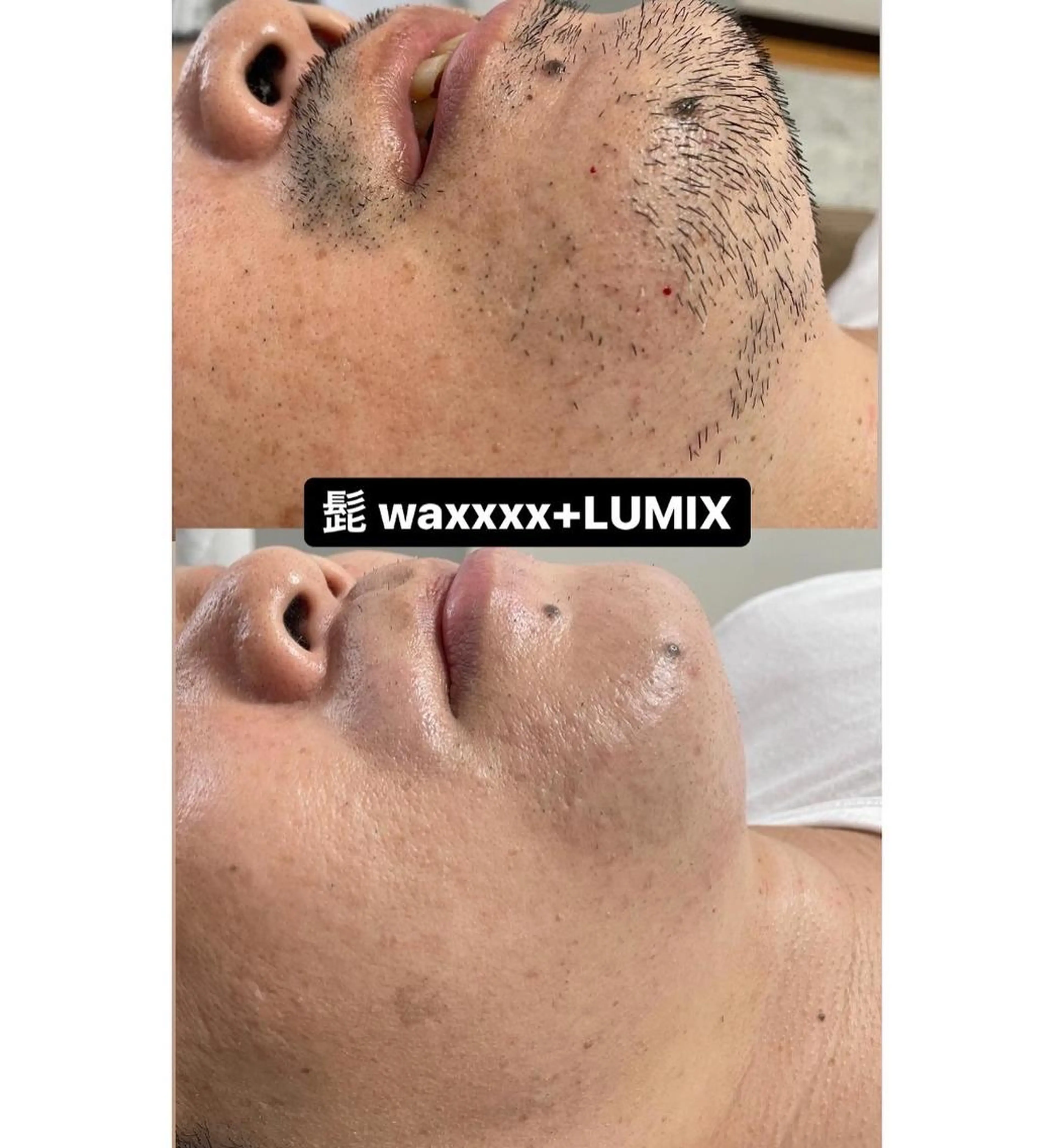 脱毛 Epina 千葉店 【エピナ】のエステ・リラクイメージ