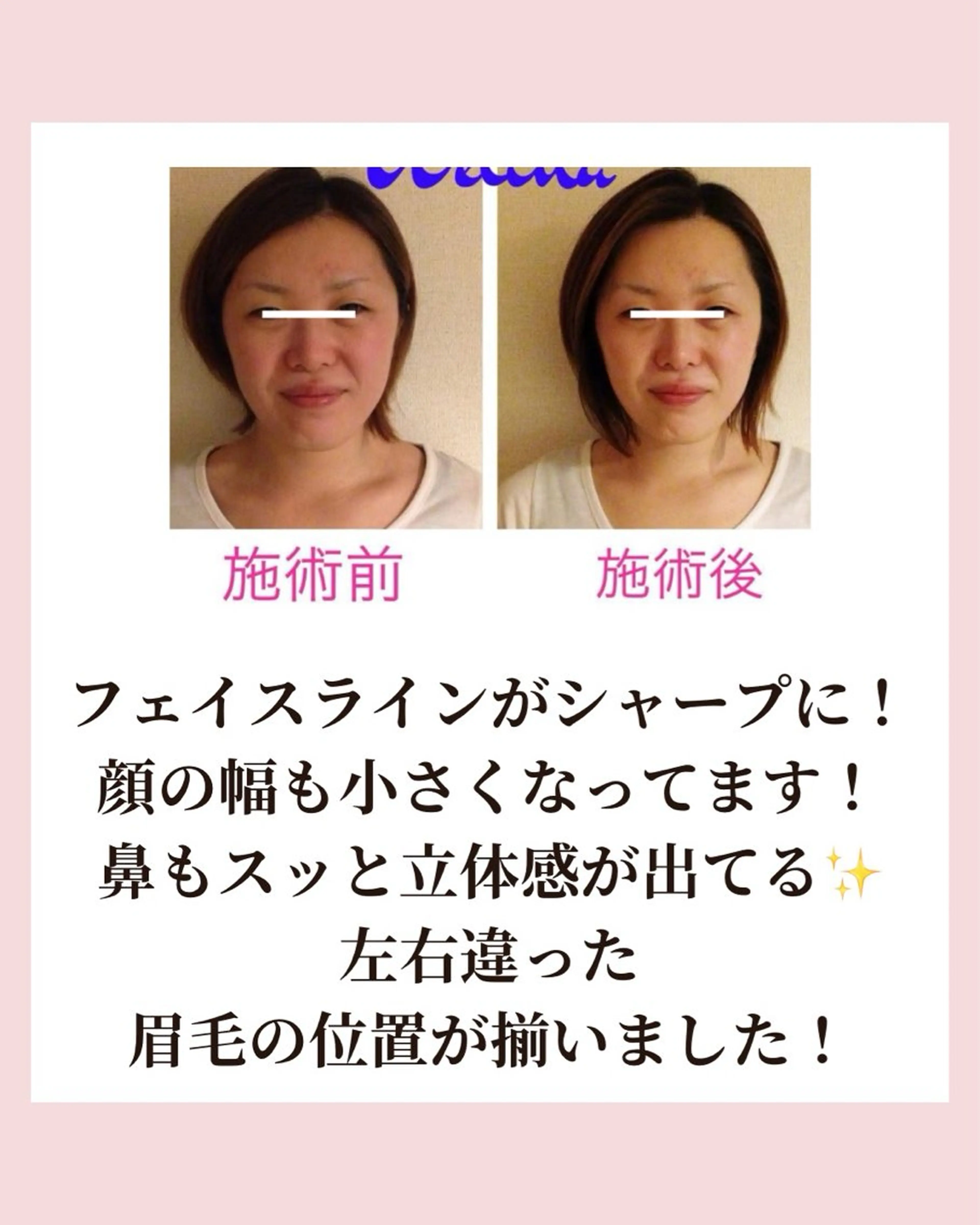 痩身・小顔・骨盤矯正×ヒップアップ専門エステ Peach所属・桃尻つかさ🍑小顔× ノーファンデ肌作りのエステ・リラクイメージ