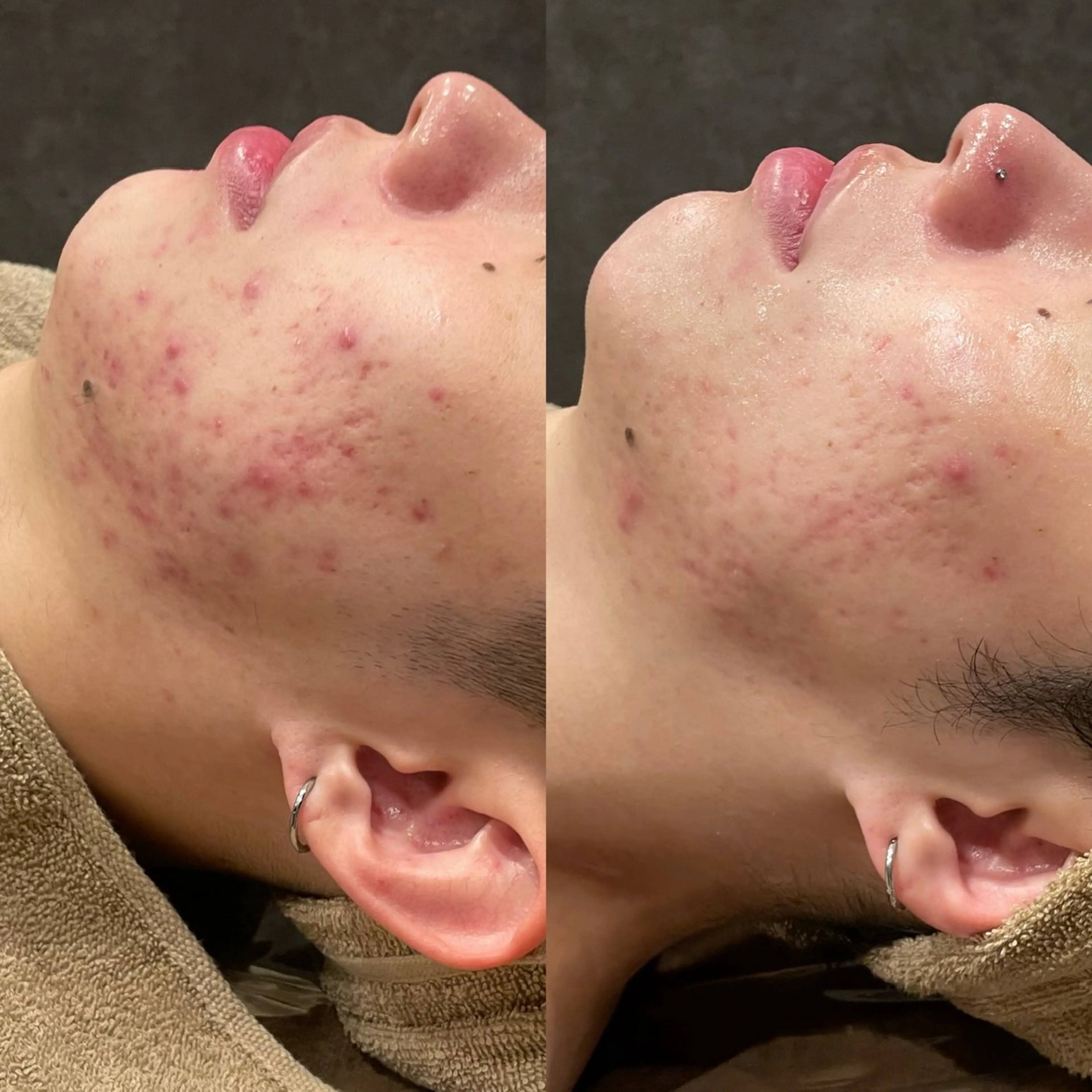 エステ Re:Belle所属・Re:Belle 久留米 : 中島のエステ・リラクイメージ