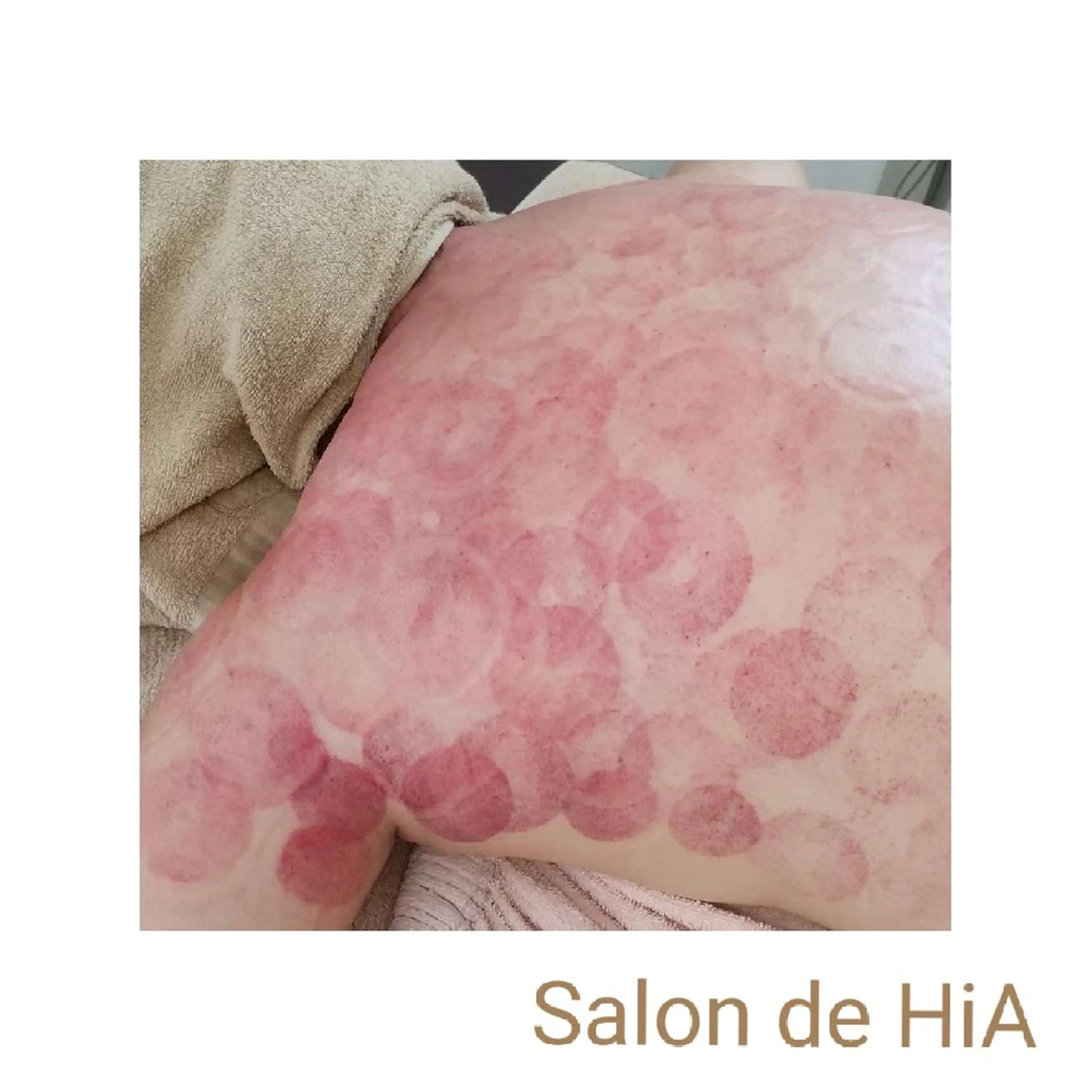 エステ リラク Salon de  HiAのエステ・リラクイメージ