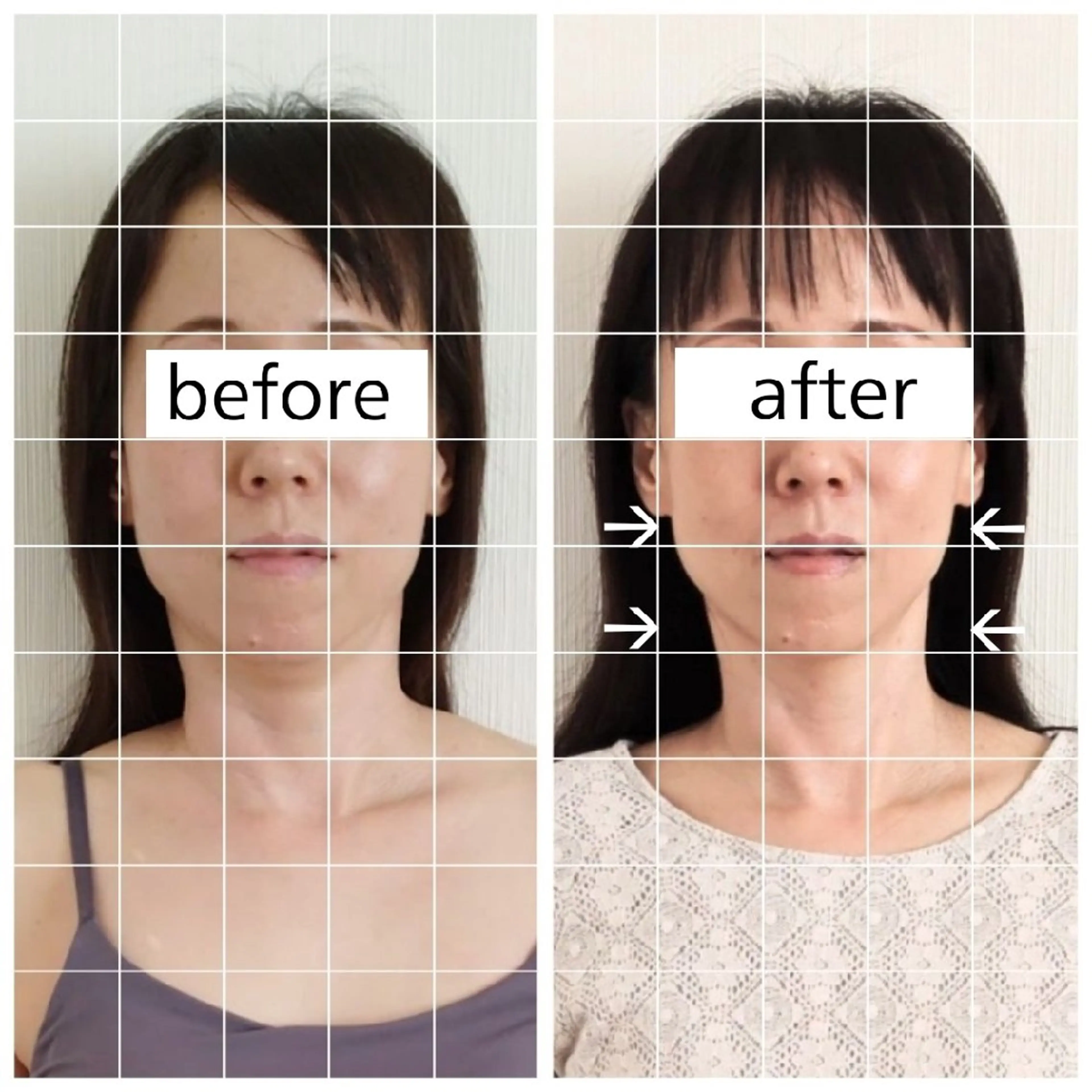 エステ リラク 桜井市|小顔・ 美容矯正 madoiのエステ・リラクイメージ