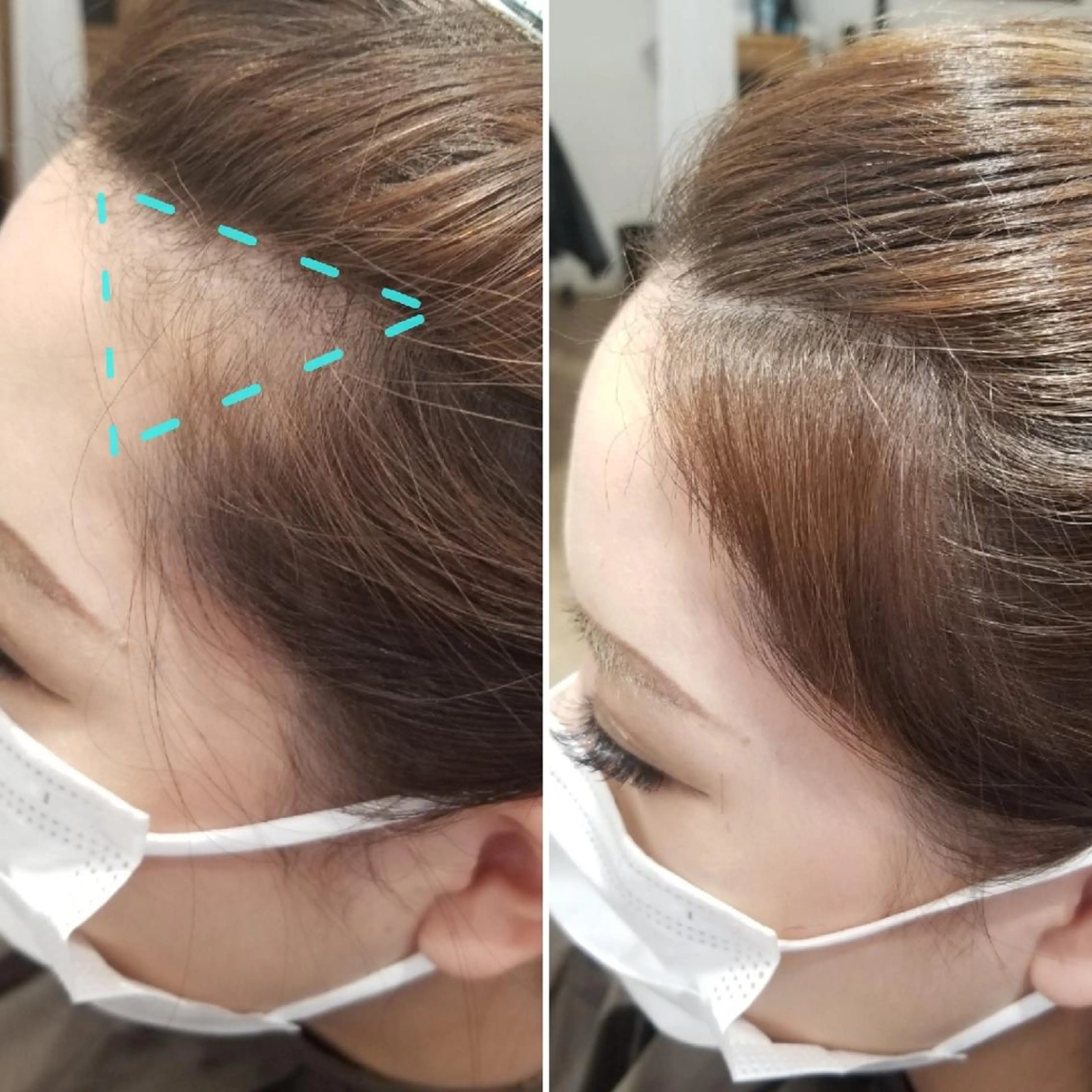 ミディアム パーマ ミディアムパーマ 小顔カット とみー 艶カラー/  大人女性のお悩み相談のヘアスタイル