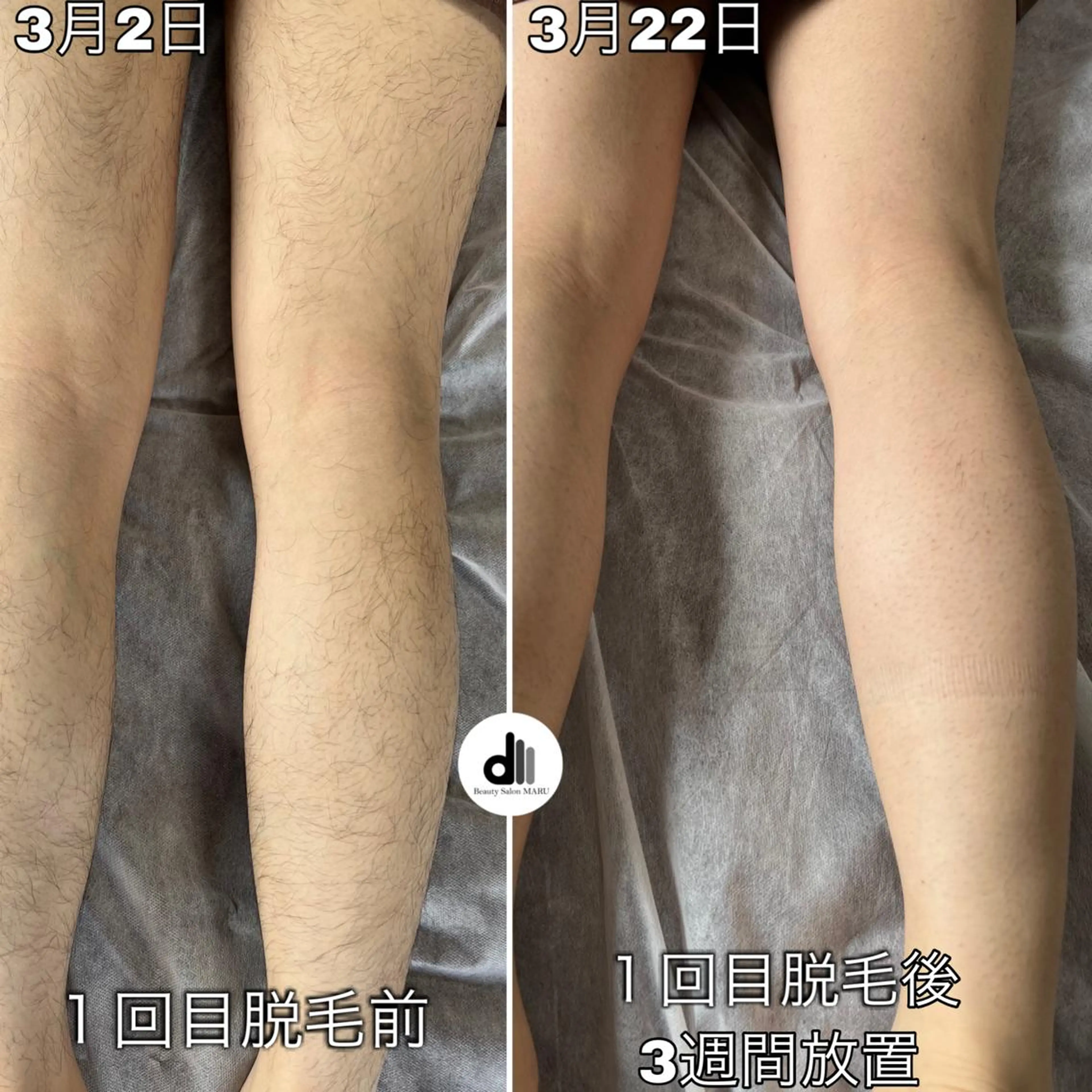 メンズ Beauty Salon MARU所属・新潟市メンズ【脱毛】 MARUのエステ・リラクイメージ