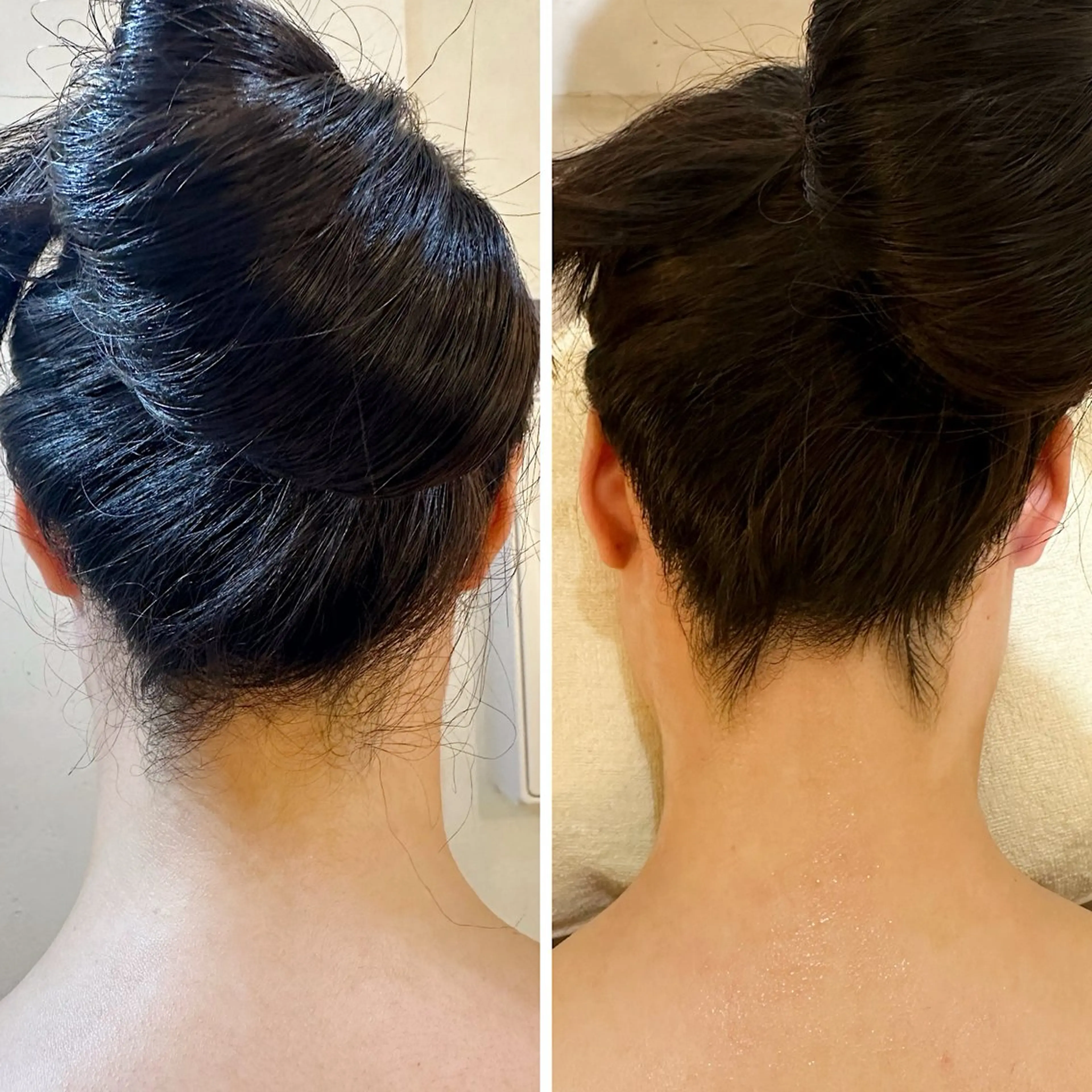 脱毛 うなじ脱毛/美肌脱毛 LABELのエステ・リラクイメージ