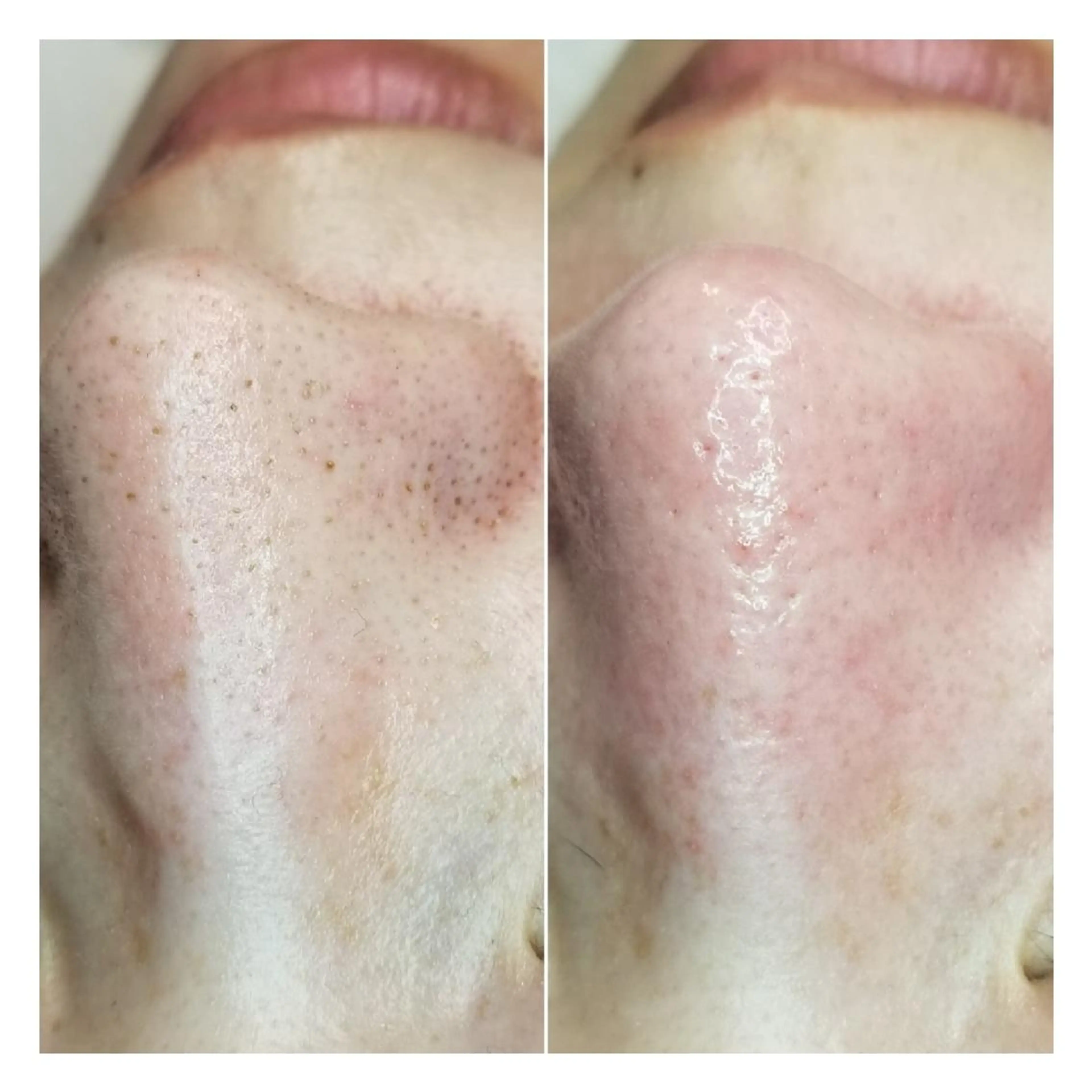 U_la所属・U_la [ウーラ] 片岡の眉毛・アイブロウイメージ