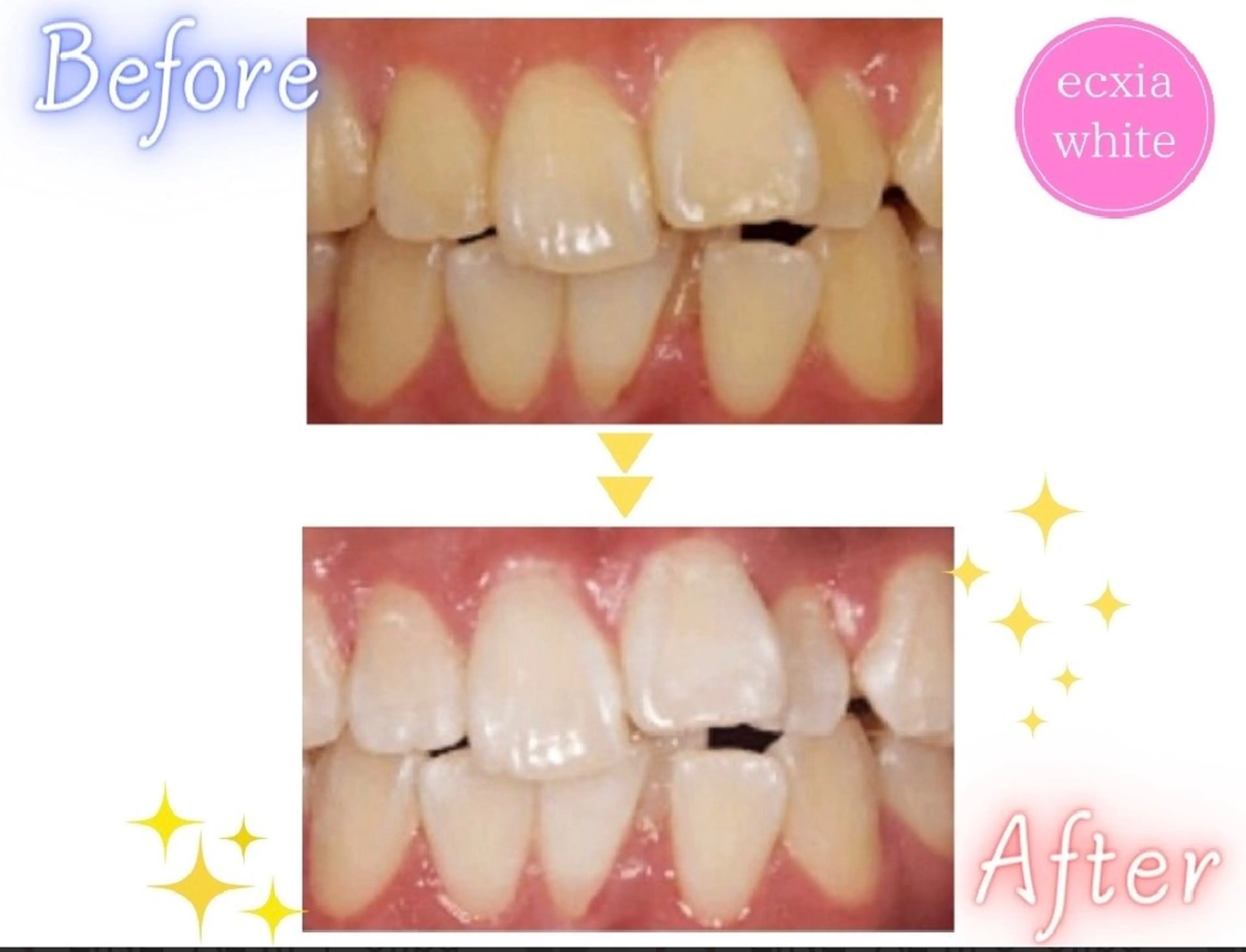 エステ エクシアホワイト 立川南口のエステ・リラクイメージ