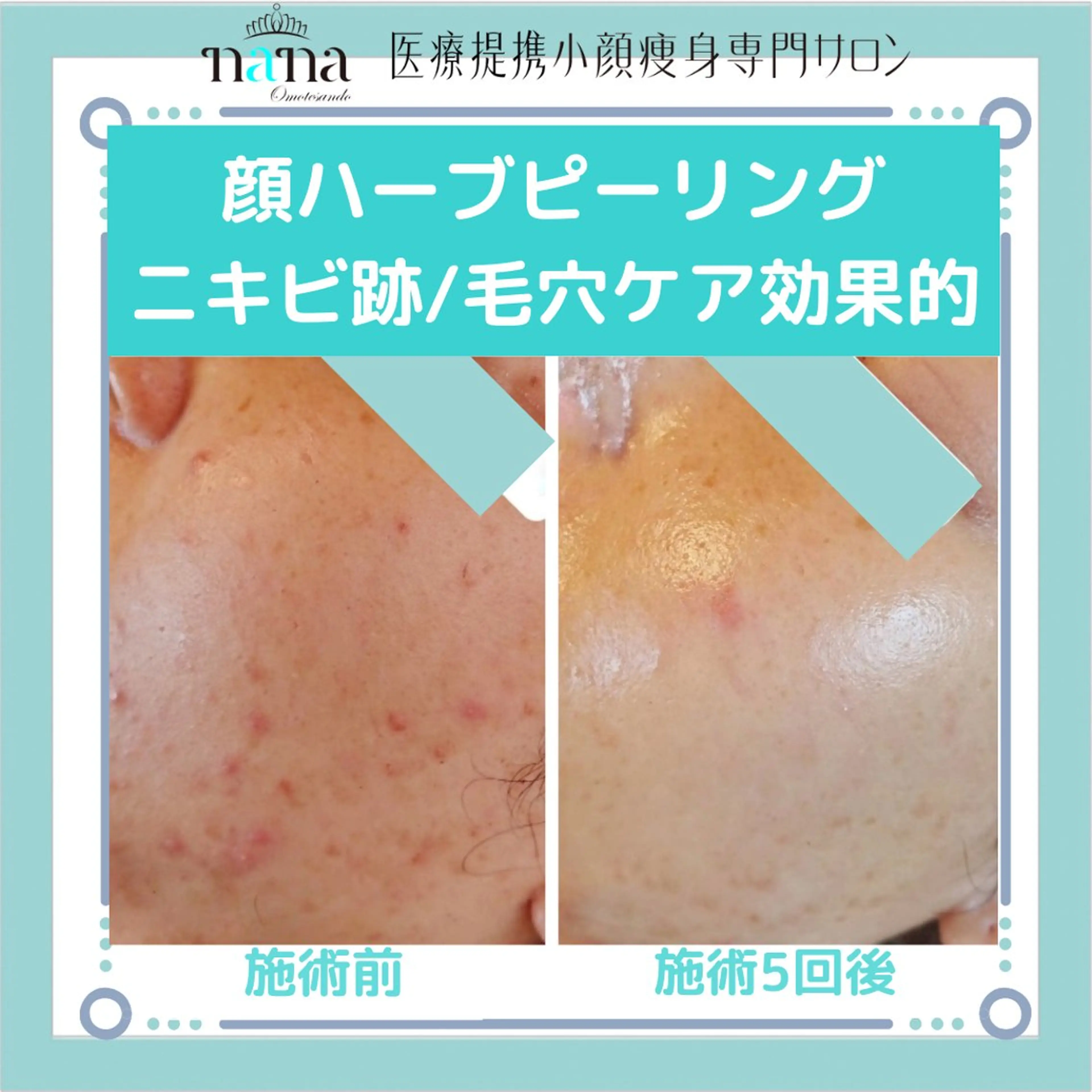 小顔痩身インディバ Nana表参道のエステ・リラクイメージ