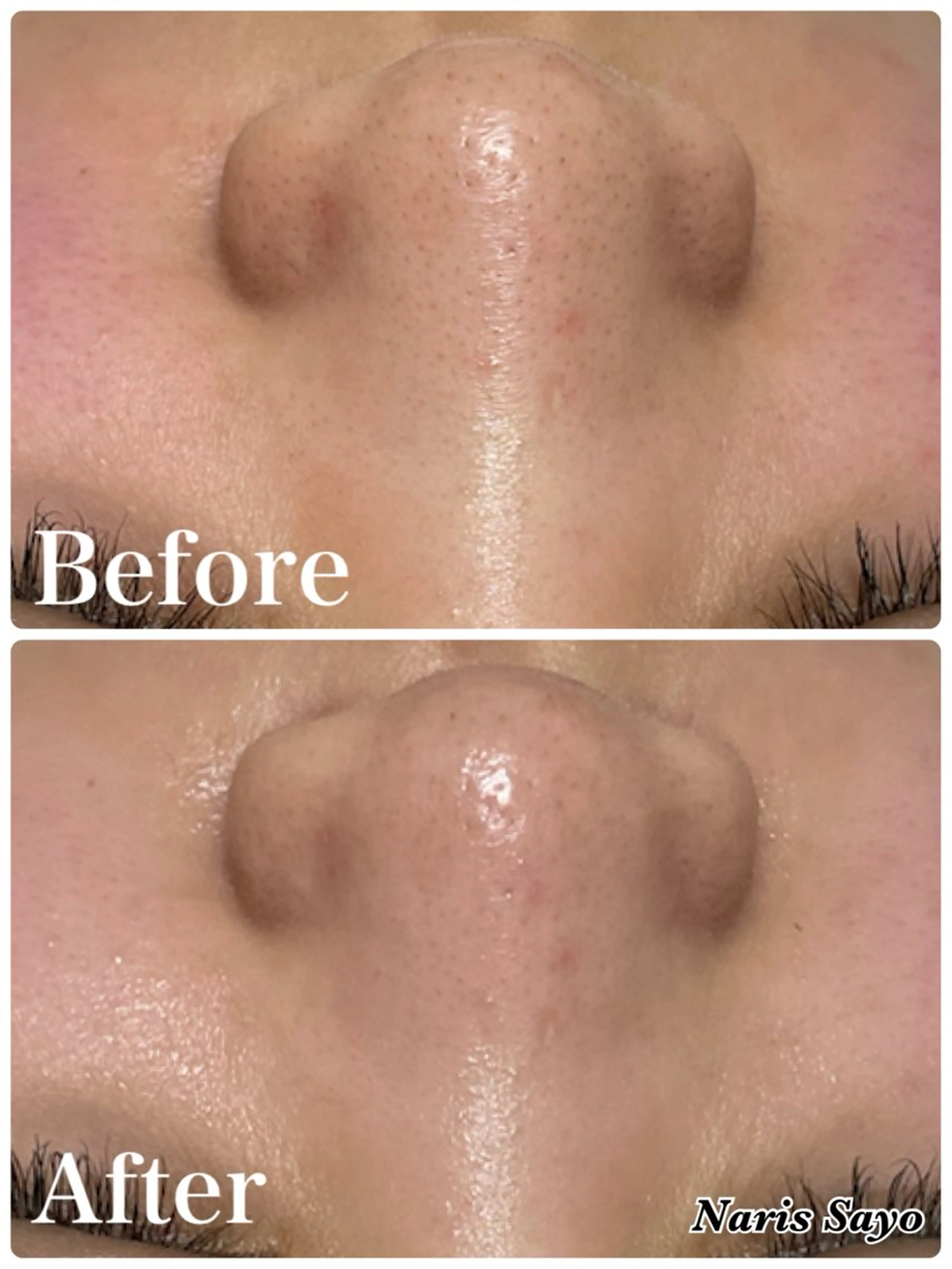 エステ デ・アイム豊中所属・朝山 紗世子のエステ・リラクイメージ