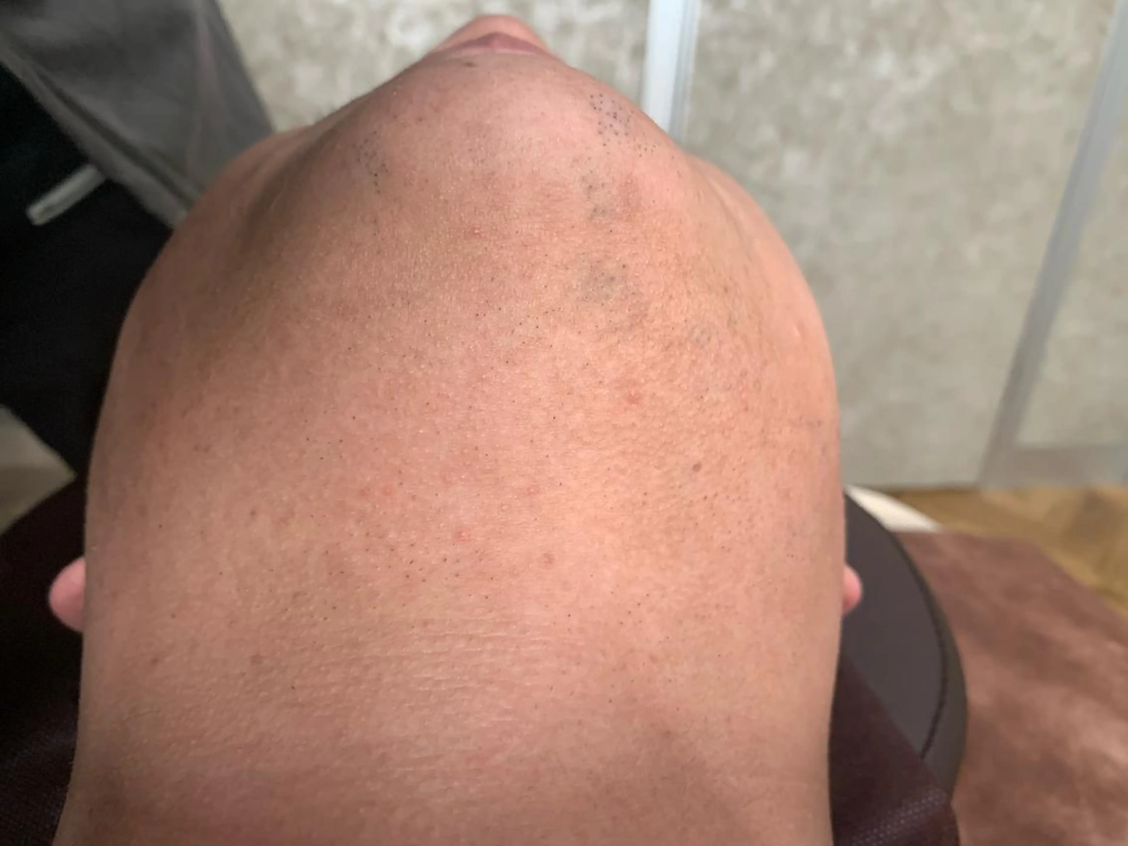 メンズ 20代から始める脱毛 salonLEPIAのエステ・リラクイメージ