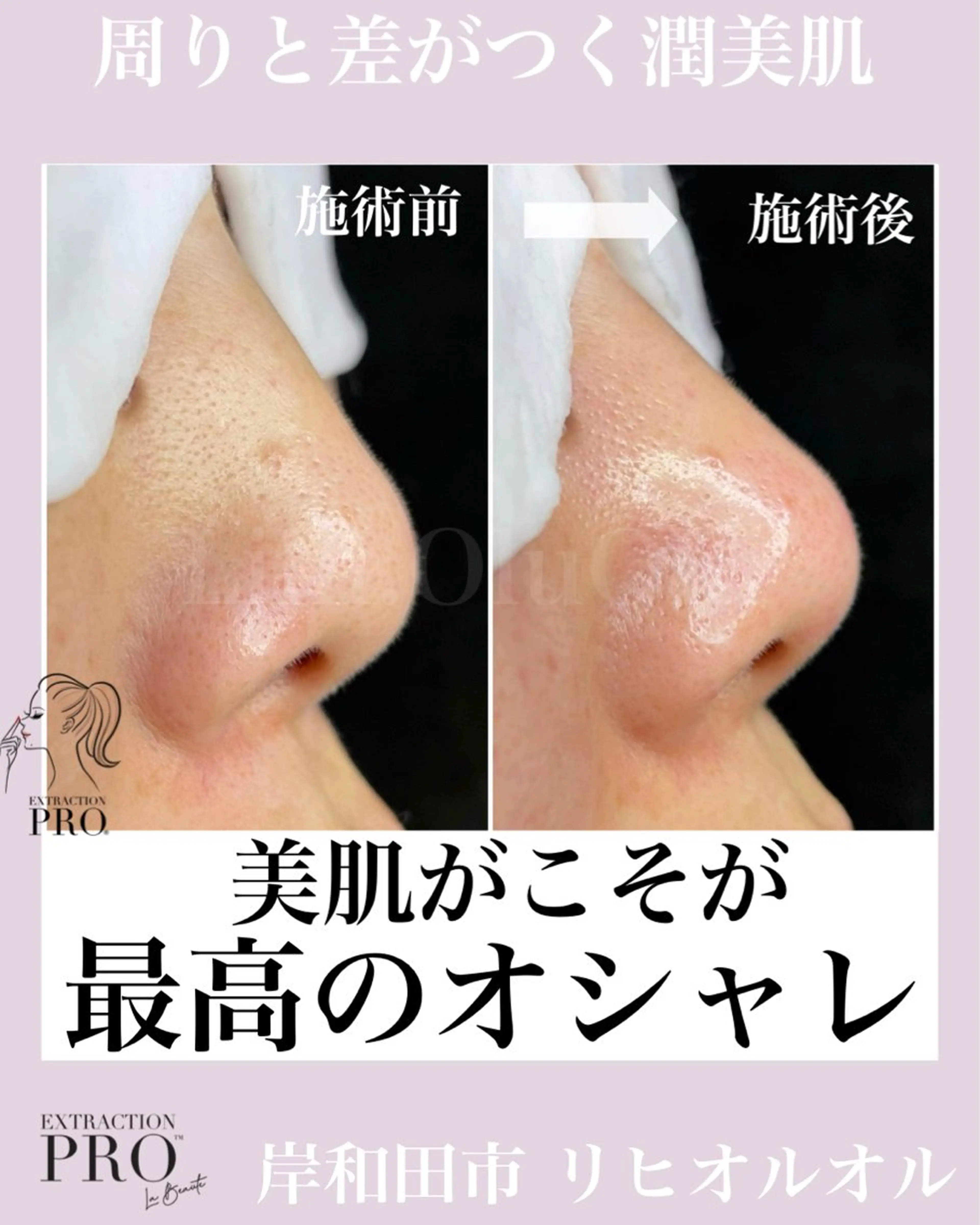 毛穴汚れ改善専門店/ 岸和田/リヒオルオルのエステ・リラクイメージ