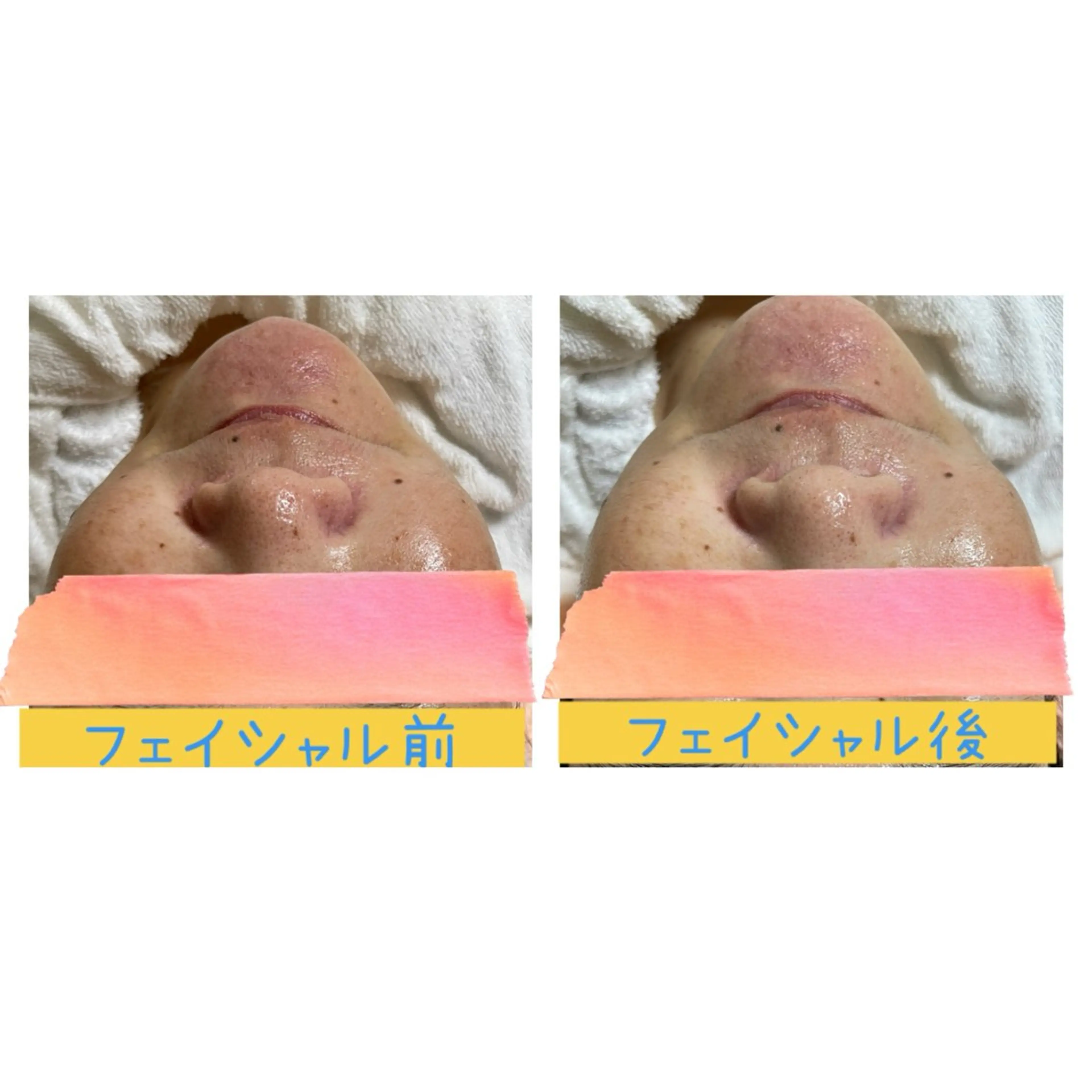 エステ 癒し×小顔×毛穴ケア サロンSourilのエステ・リラクイメージ