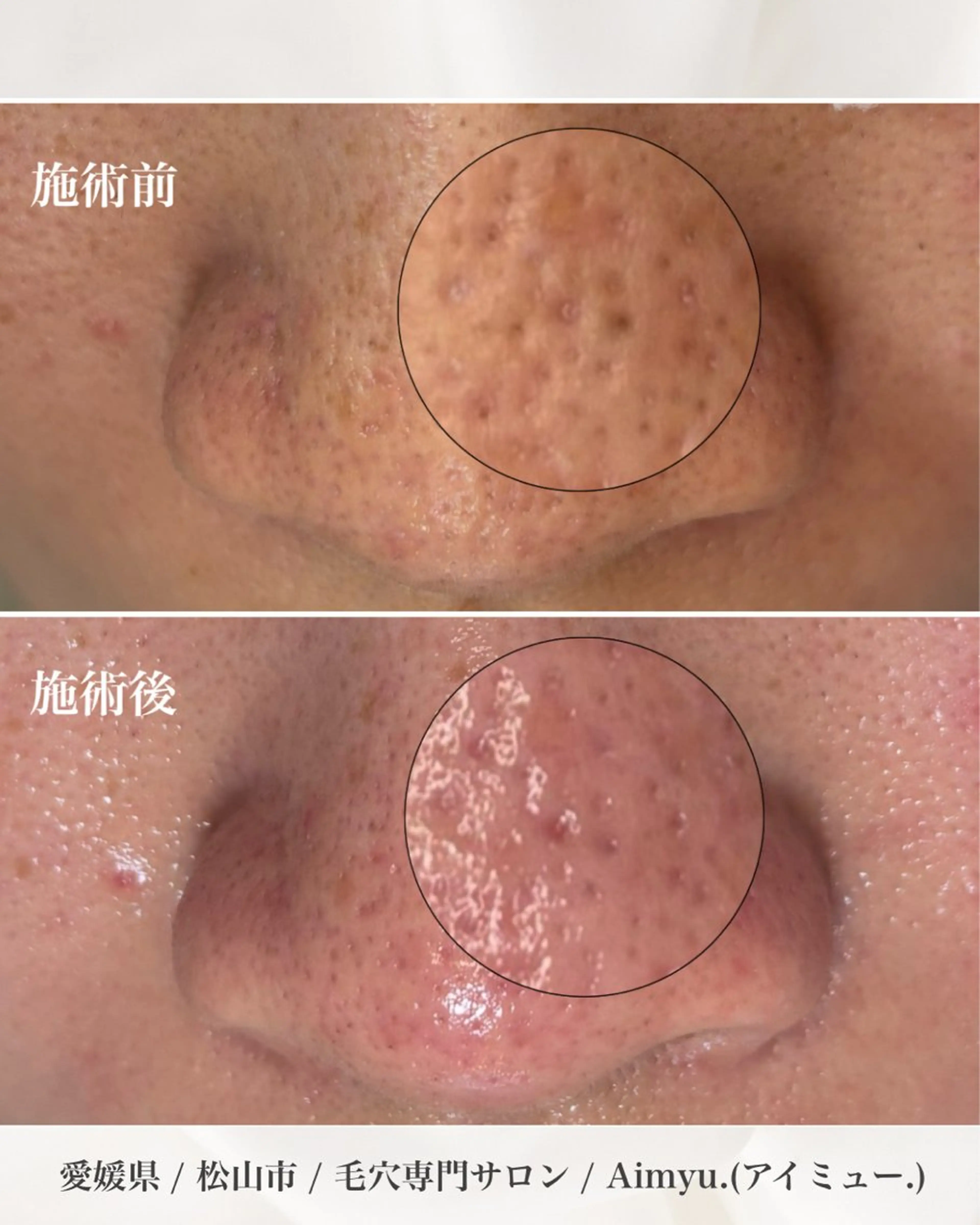 毛穴専門店アイミュー mamiのエステ・リラクイメージ