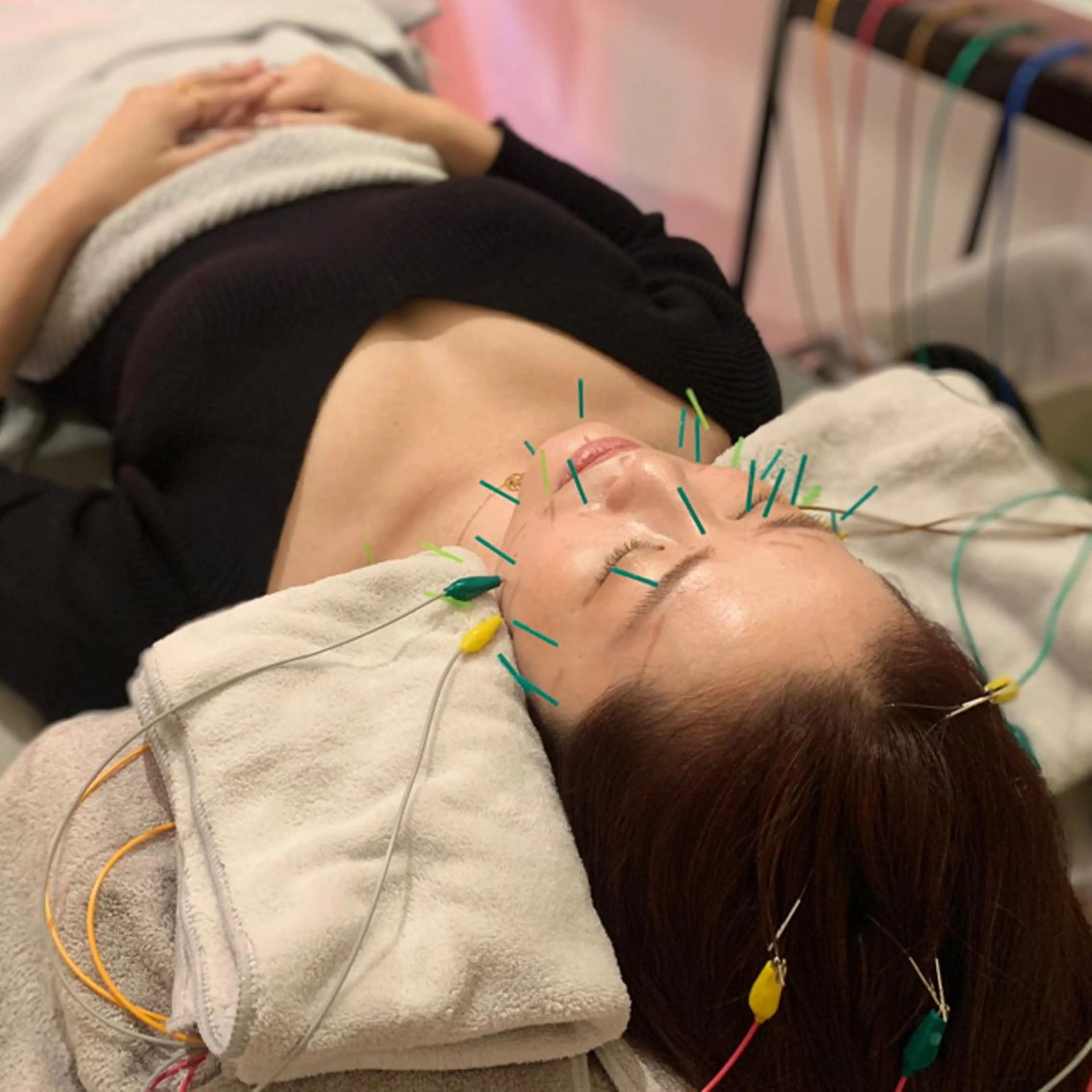 新宿hari-me所属・美容鍼hari-me 新宿のエステ・リラクイメージ