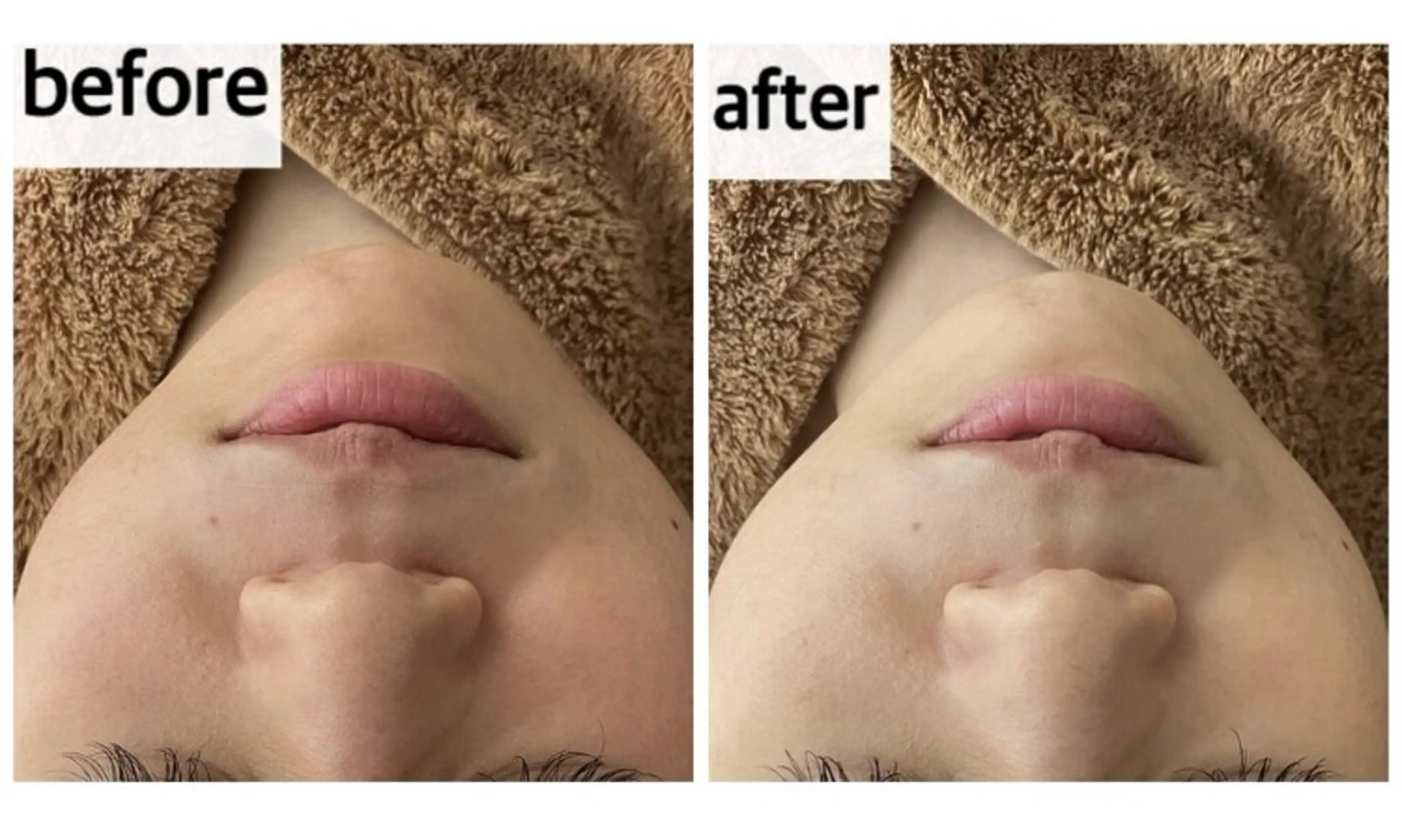 エステ メナード岐阜茜部 杉浦のエステ・リラクイメージ