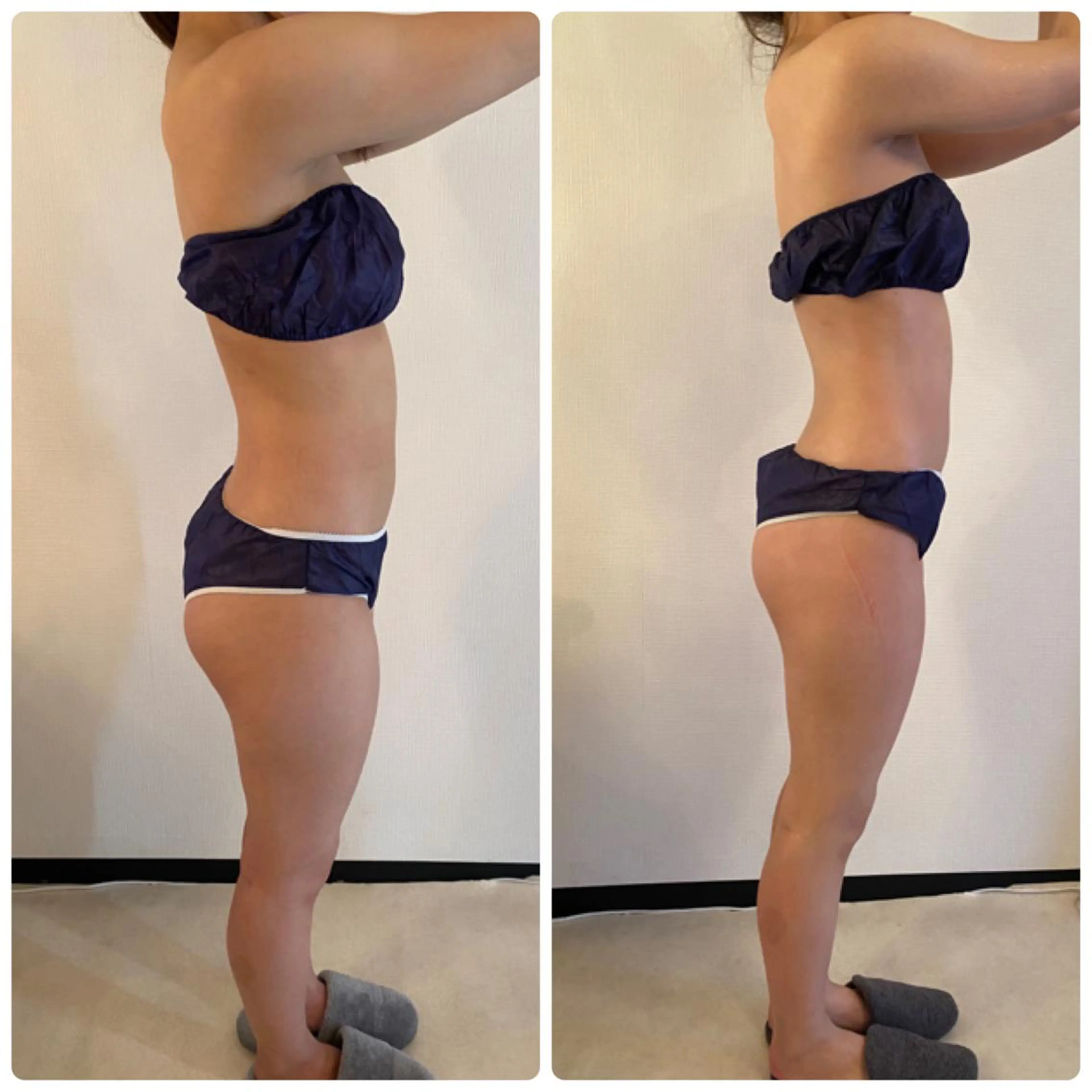 FLEUR大阪・整体 ・ハイフ・痩身・小顔のエステ・リラクイメージ