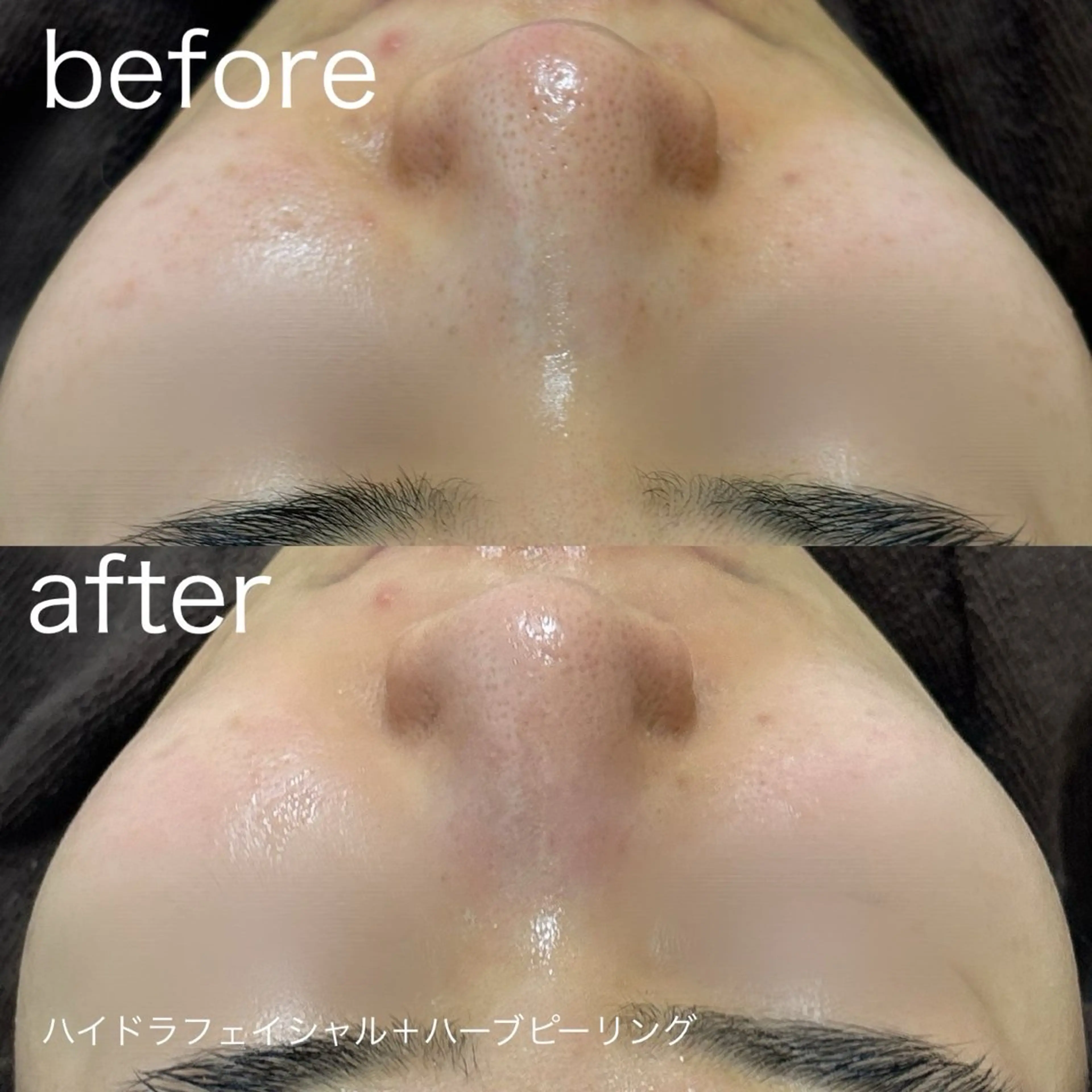 その他 lulularico Yu🫧のエステ・リラクイメージ