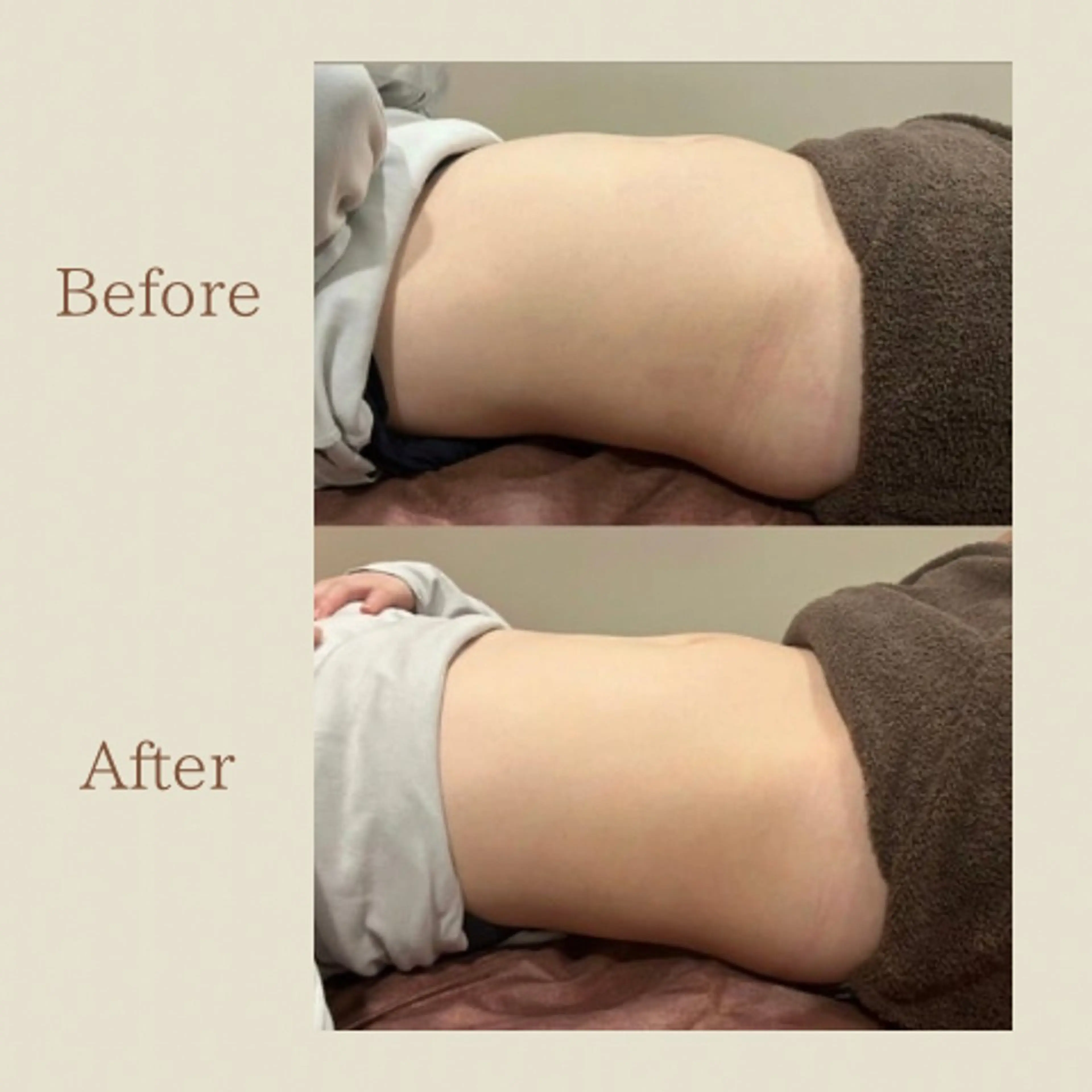 お腹痩せエステ Flat BELLY 恵比寿所属・【腸もみ/脂肪冷却】 お腹エステ/恵比寿のエステ・リラクイメージ