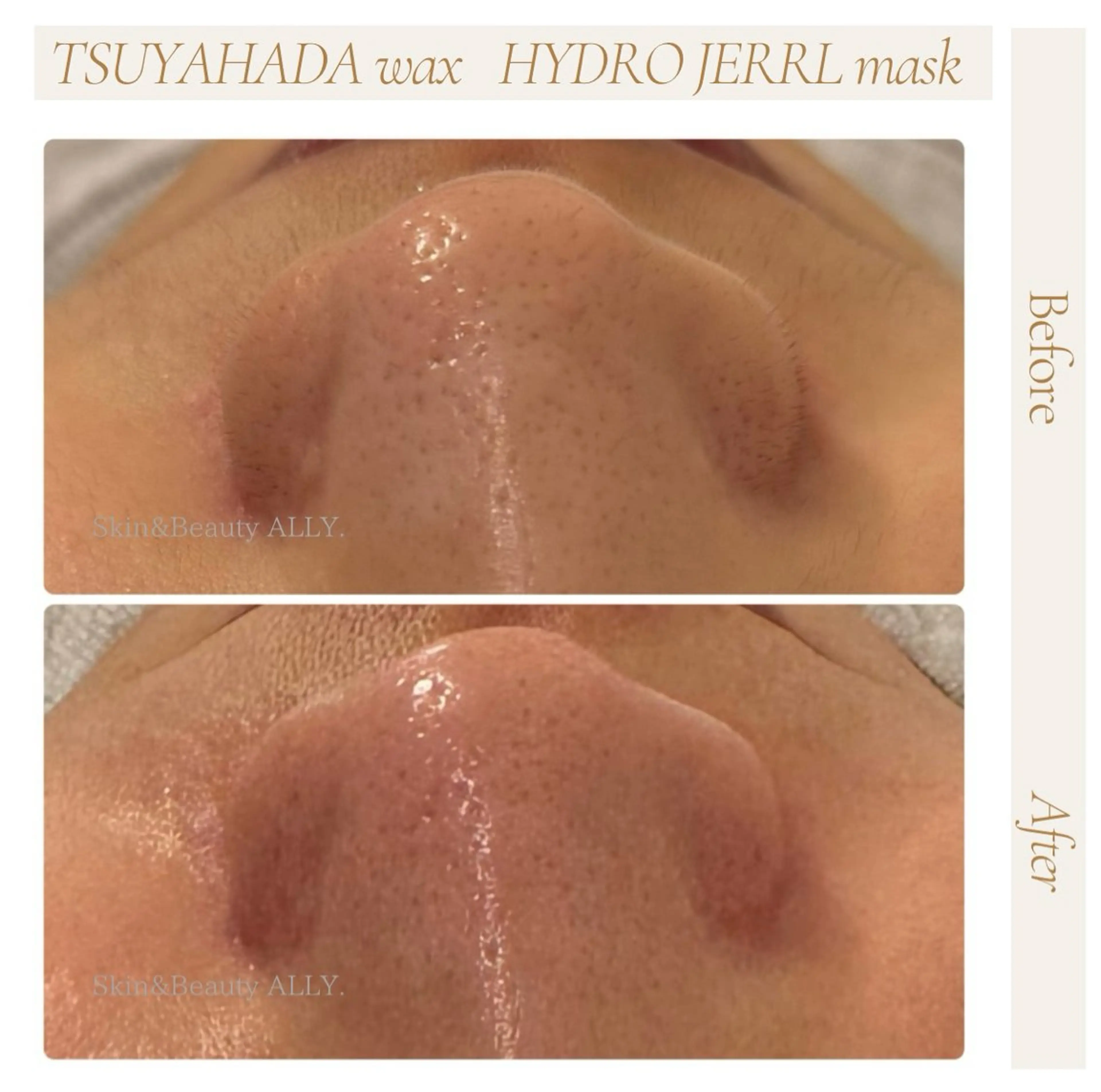 艶肌ワックス ALLY.のエステ・リラクイメージ