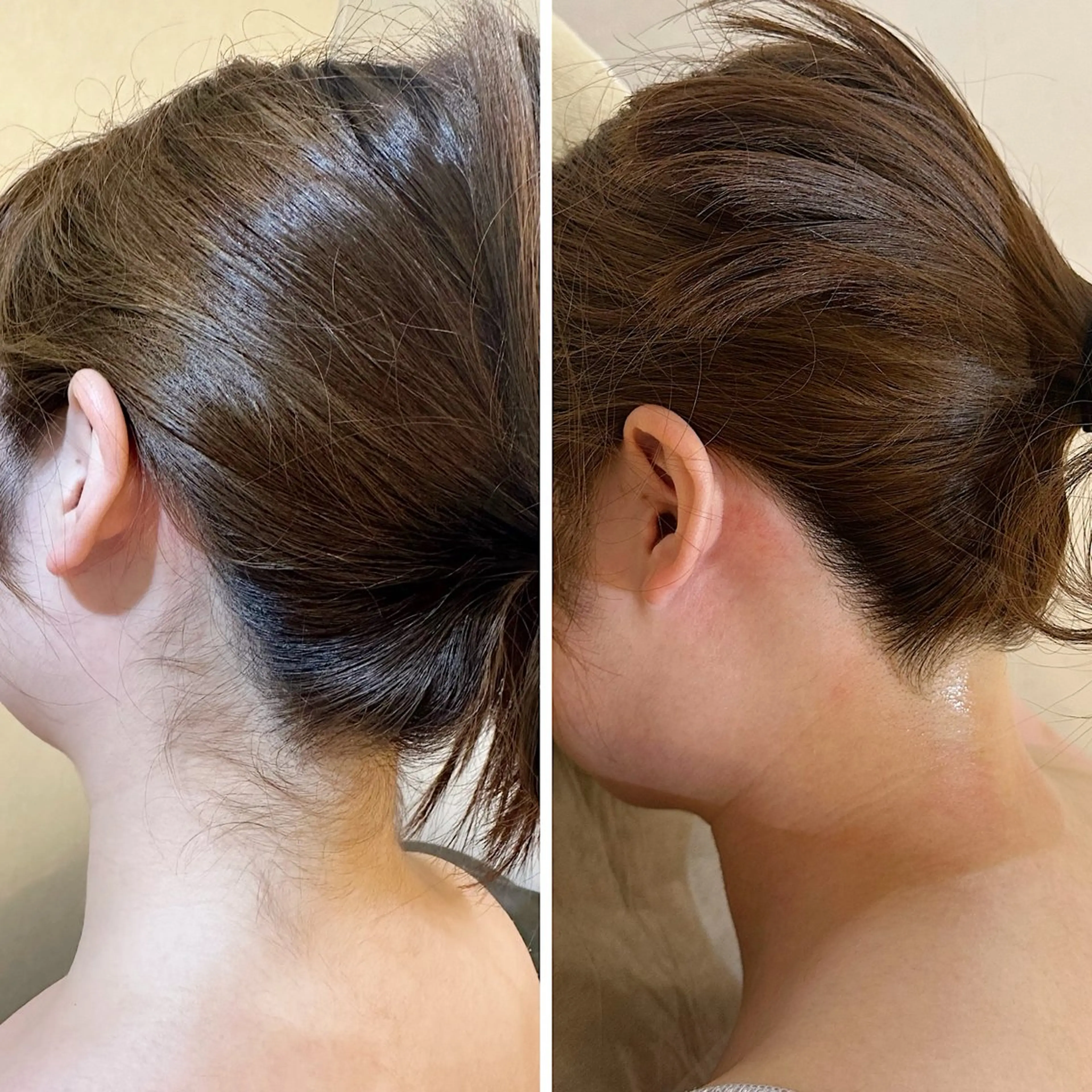 脱毛 うなじ脱毛/美肌脱毛 LABELのエステ・リラクイメージ