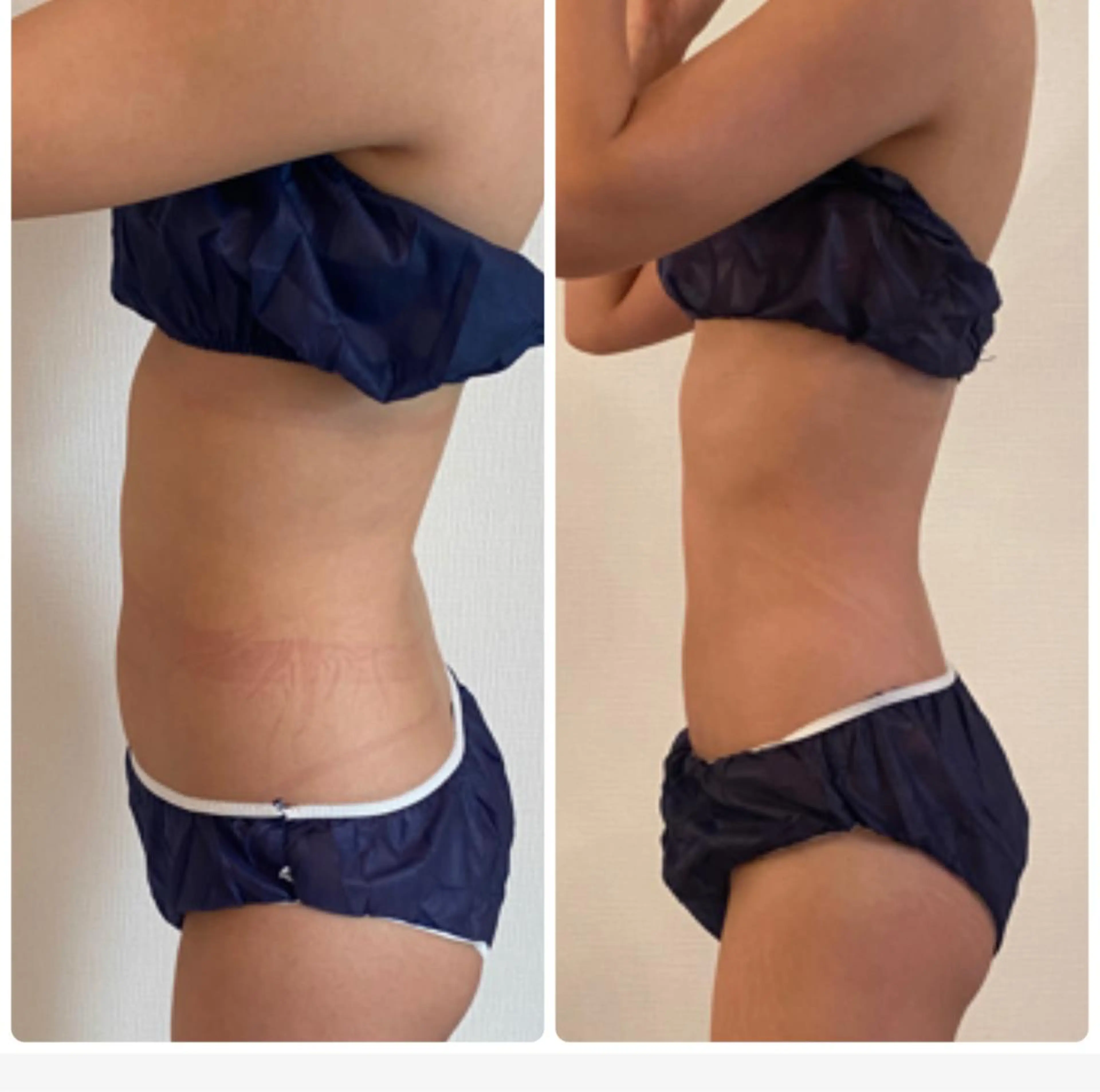 FLEUR大阪・整体 ・ハイフ・痩身・小顔のエステ・リラクイメージ