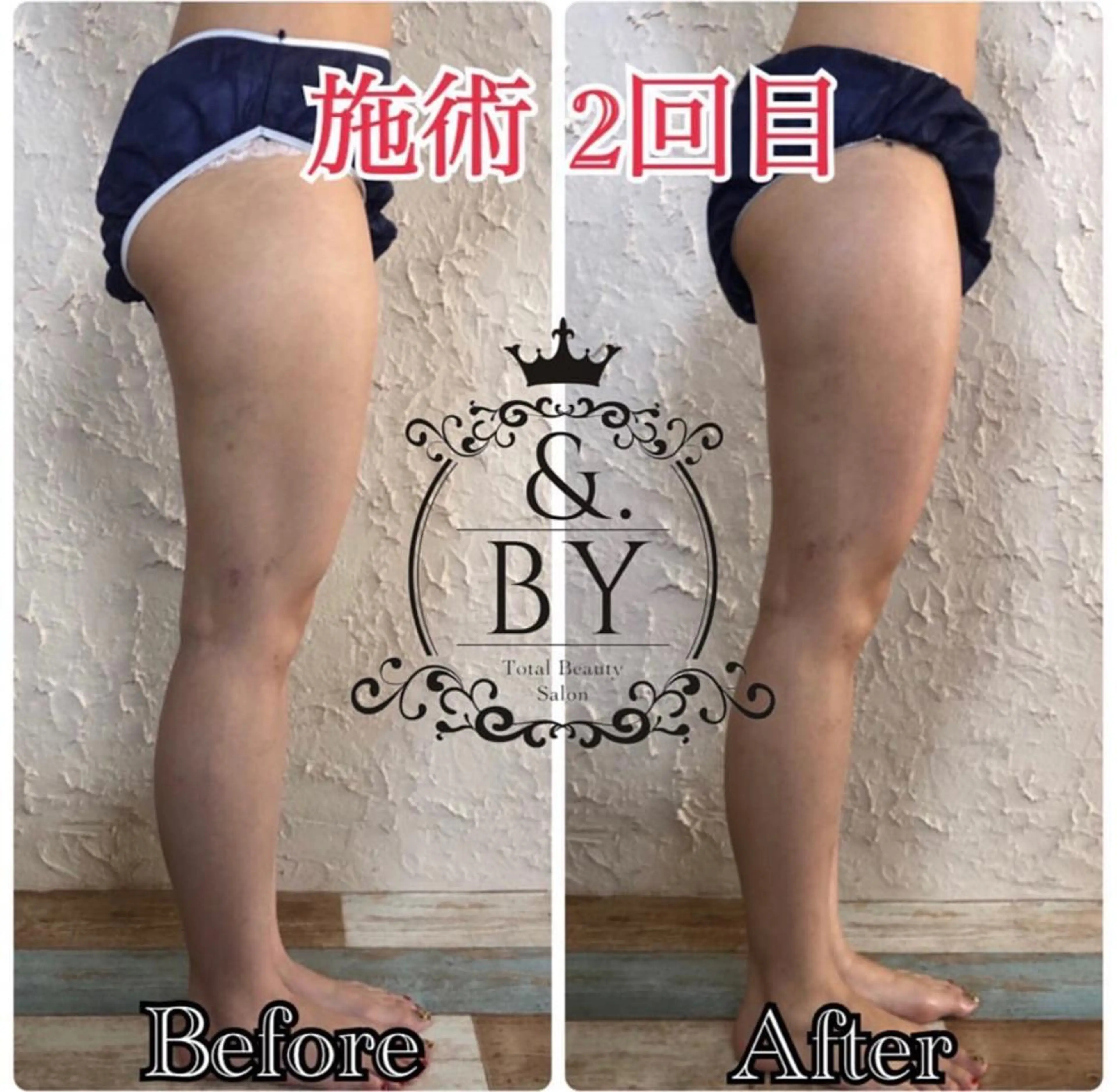 &. BYのエステ・リラクイメージ