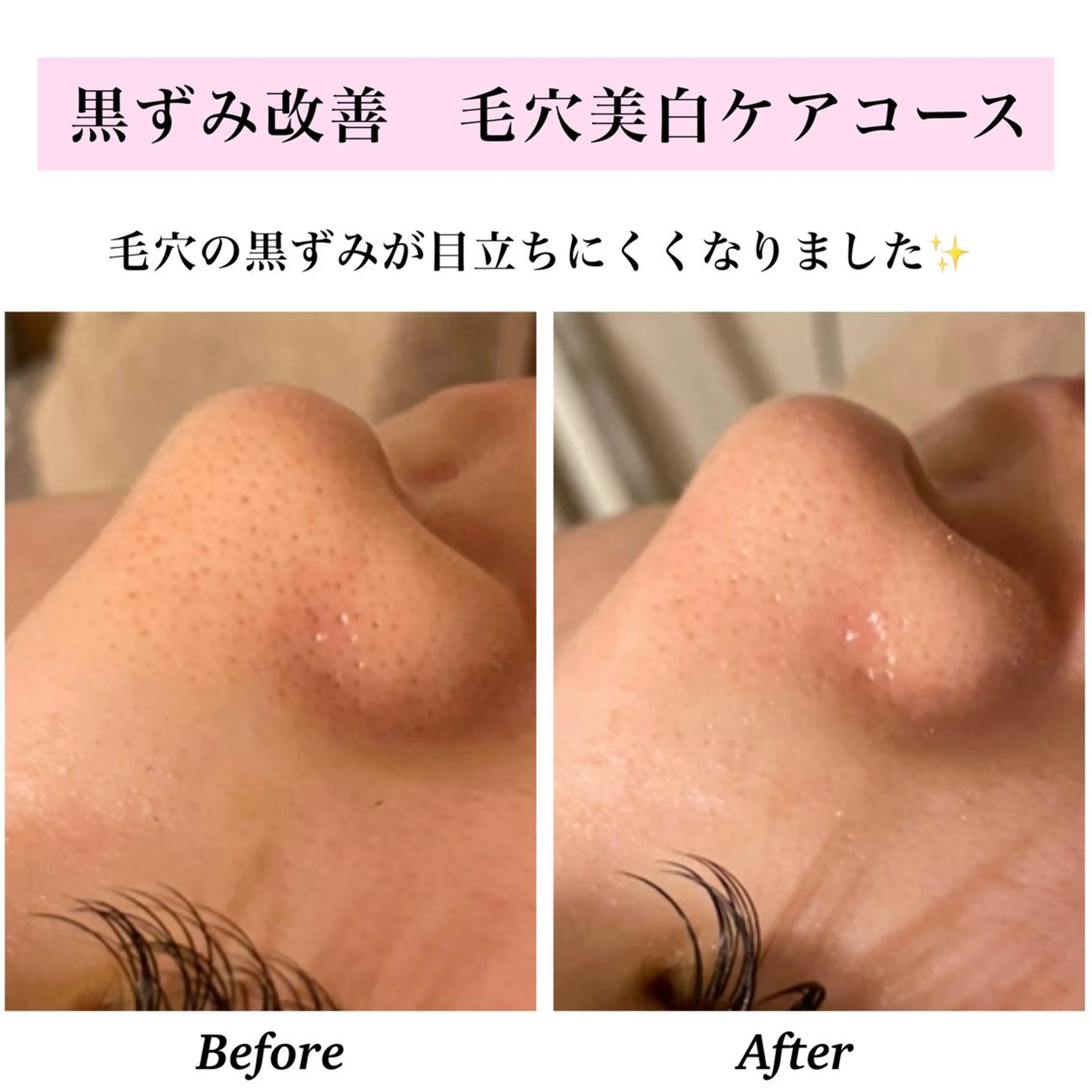 エステ リラク Bellesthe (ベルエステ)のエステ・リラクイメージ