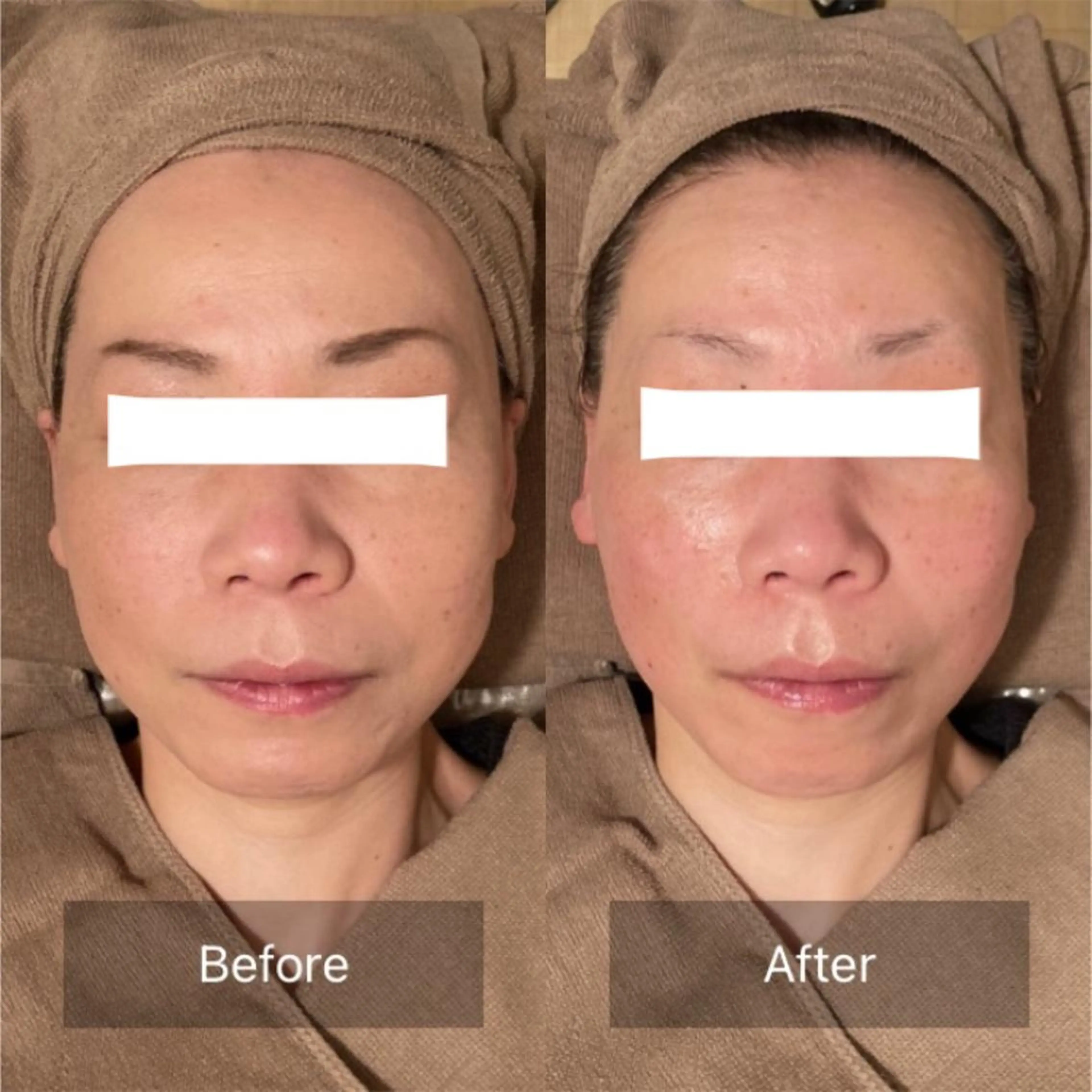 エステ リラク Ｂ&H所属・頭痛•肩こり専門/ 眉サロンB&H心斎橋のエステ・リラクイメージ