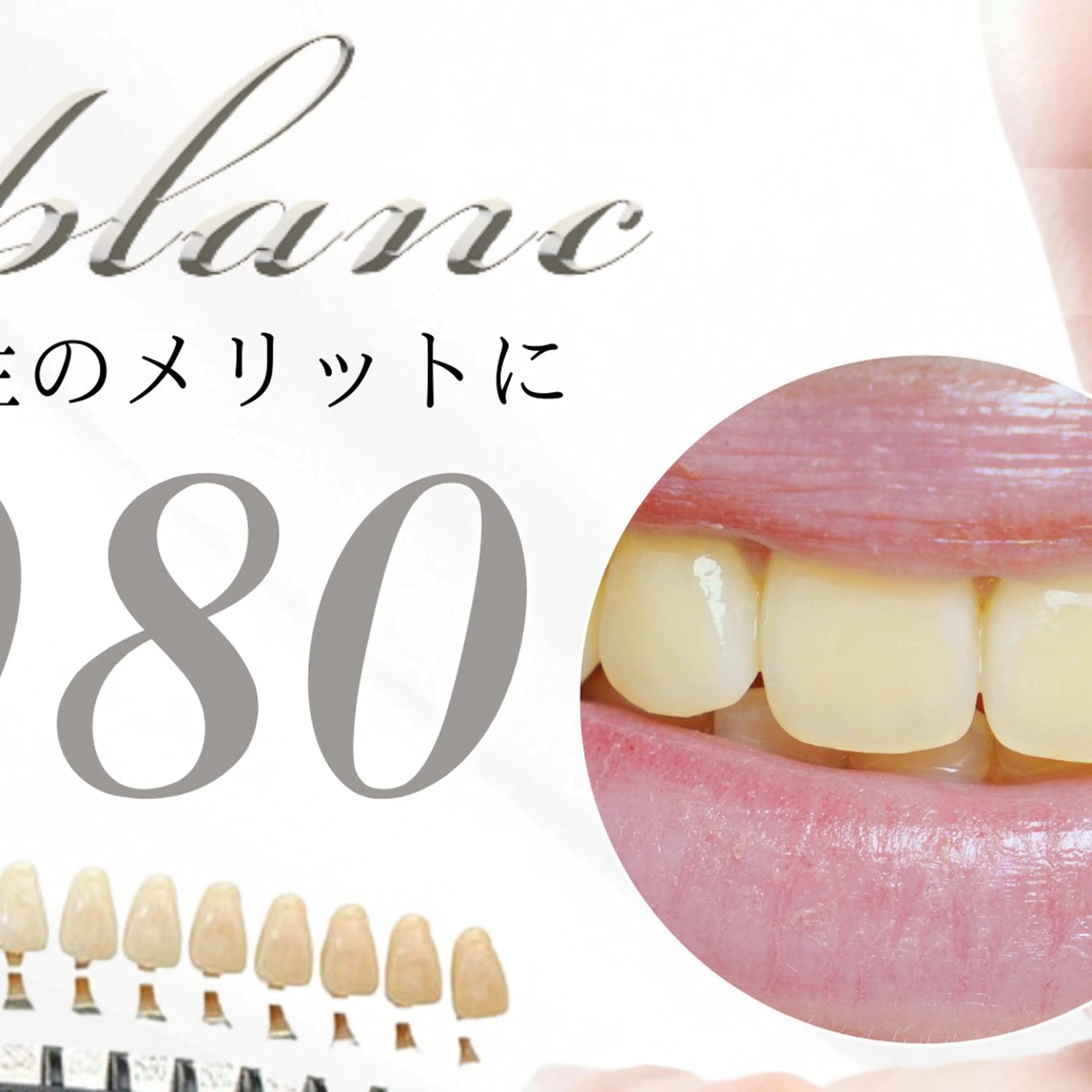 ホワイトニング MIBLANC上野店のその他イメージ