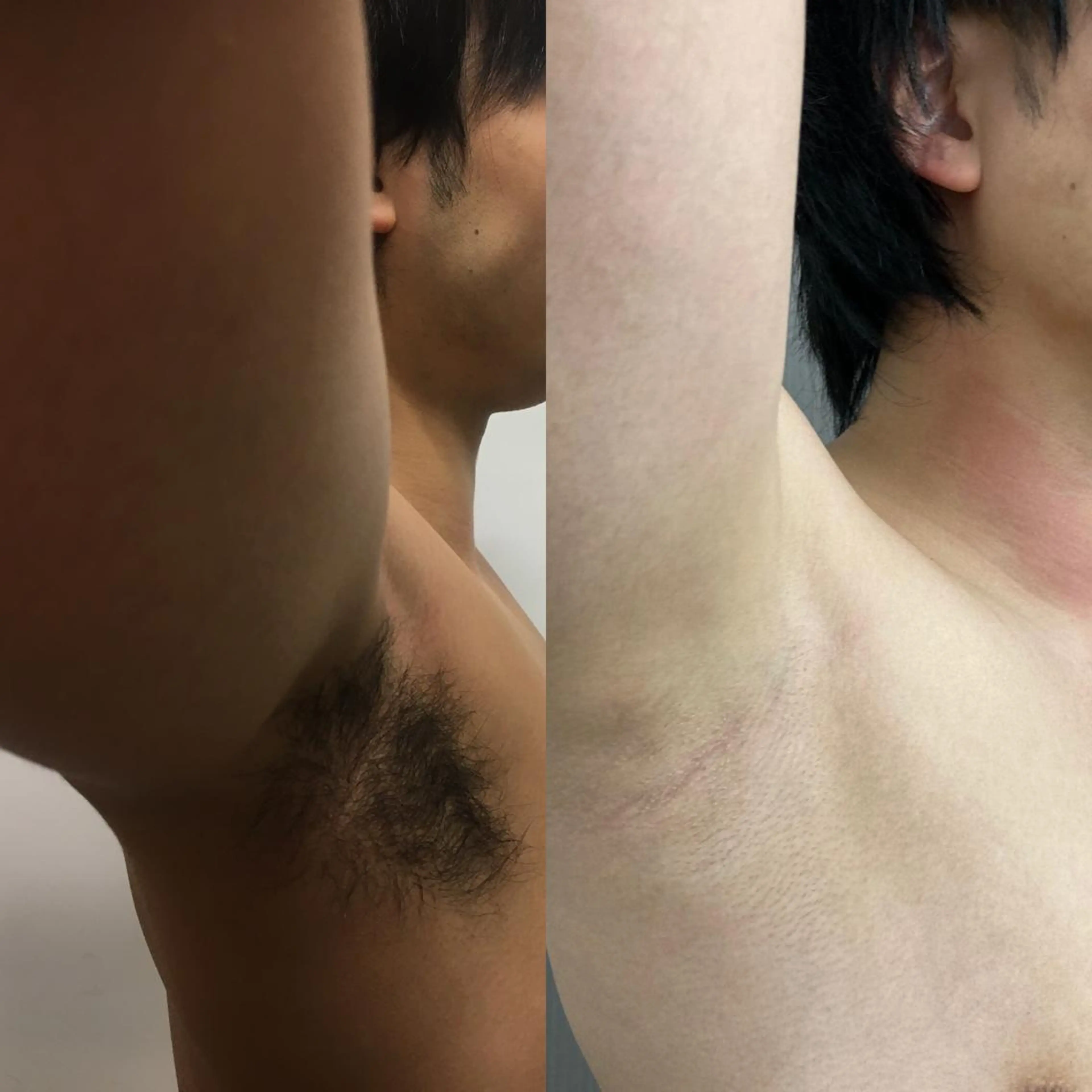 メンズ 脱毛 Beauty K's【ビューティーケイズ】所属・メンズ脱毛サロン ／金山昌弘のエステ・リラクイメージ