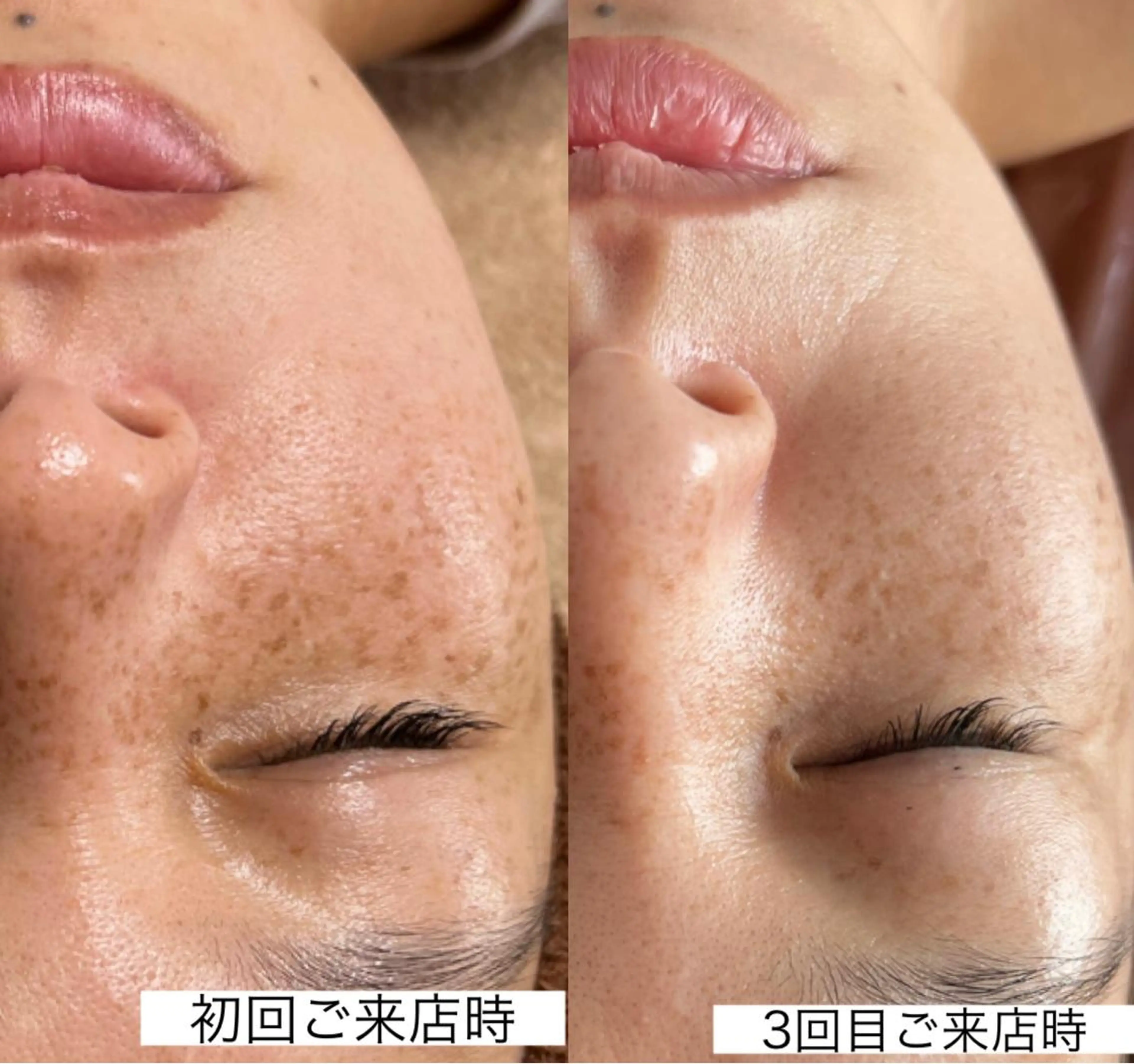 Beauty   Salon  Adiy所属・Adiy ikumiのエステ・リラクイメージ