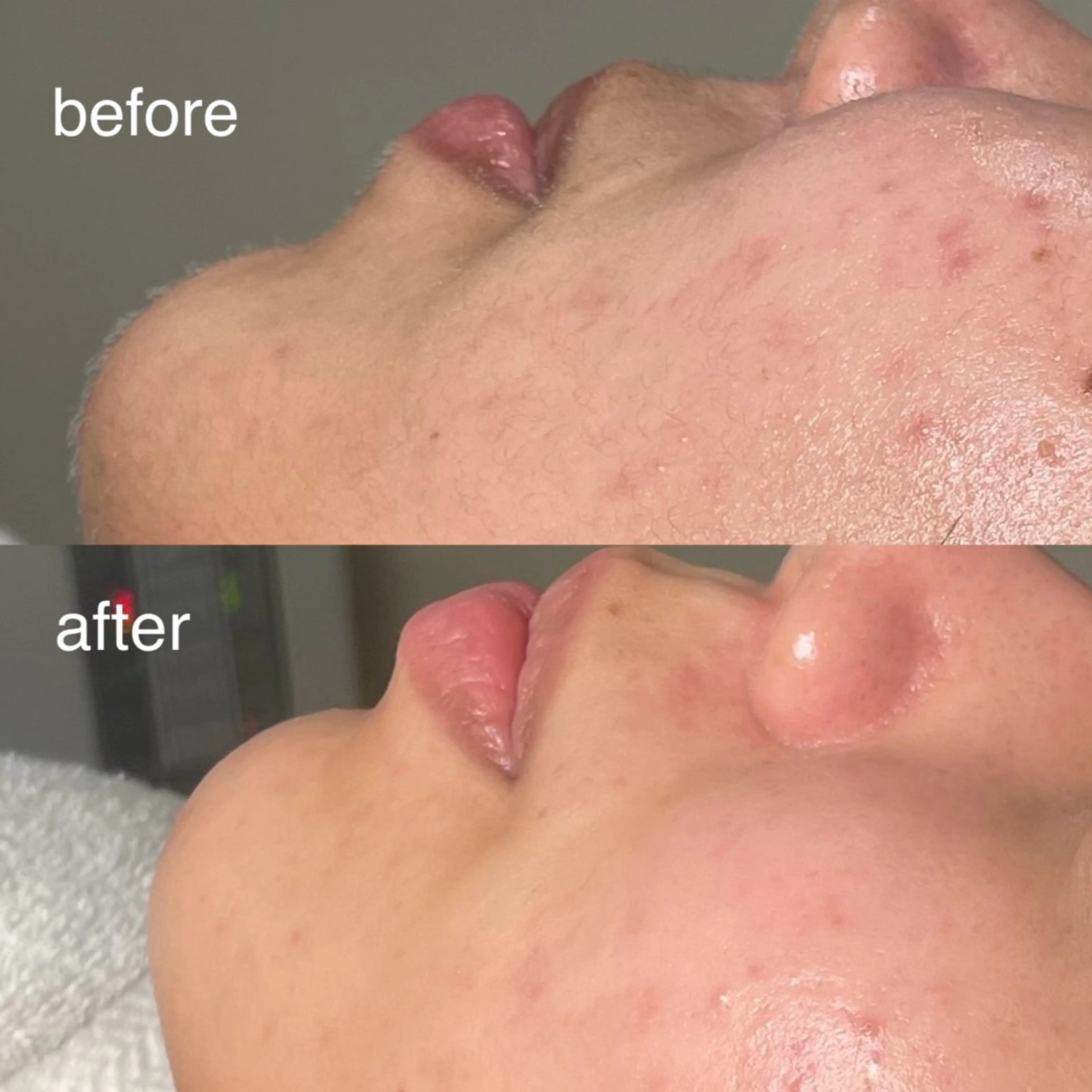 岡林 咲良のヘアスタイル