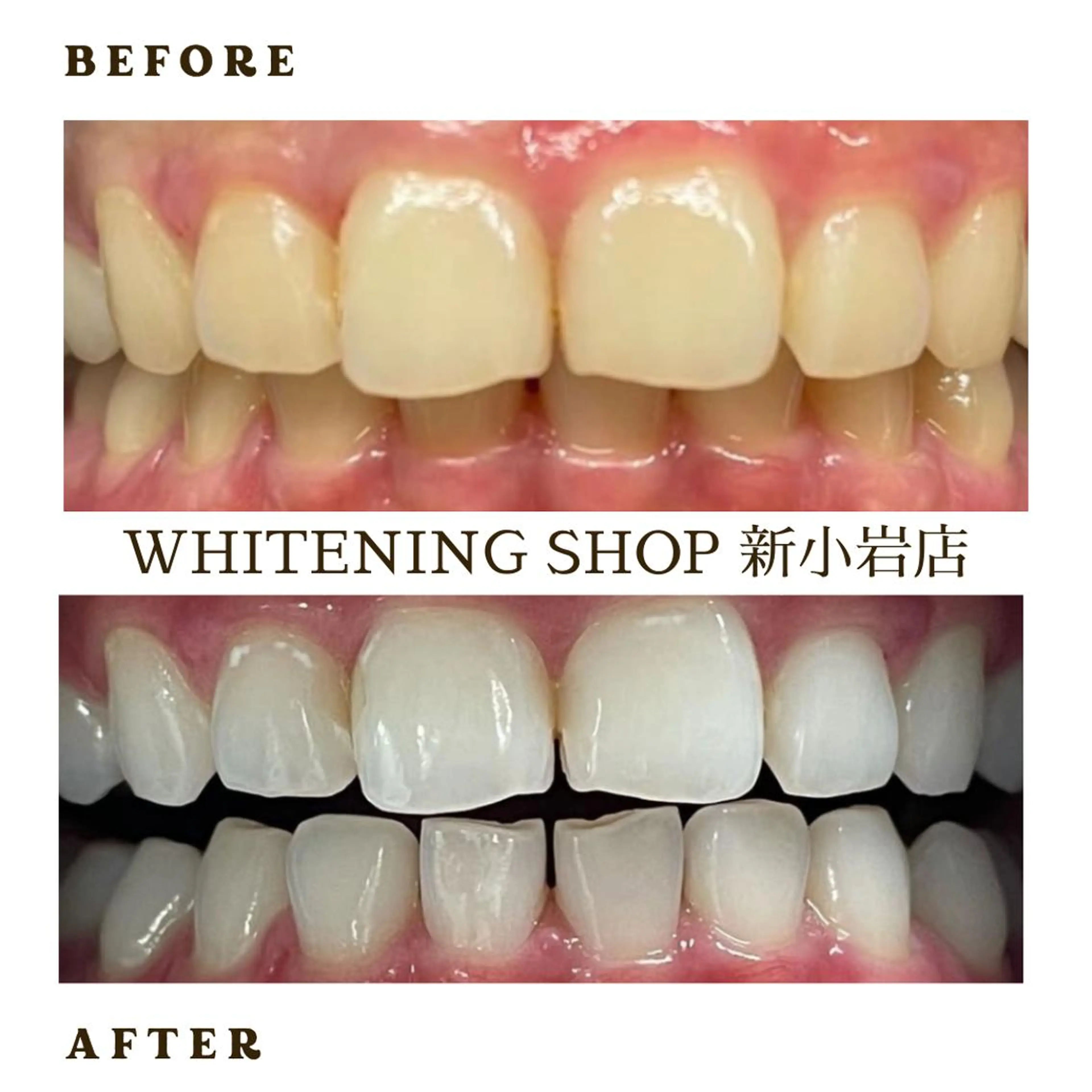 メンズ その他 ホワイトニング ショップ新小岩店のその他イメージ