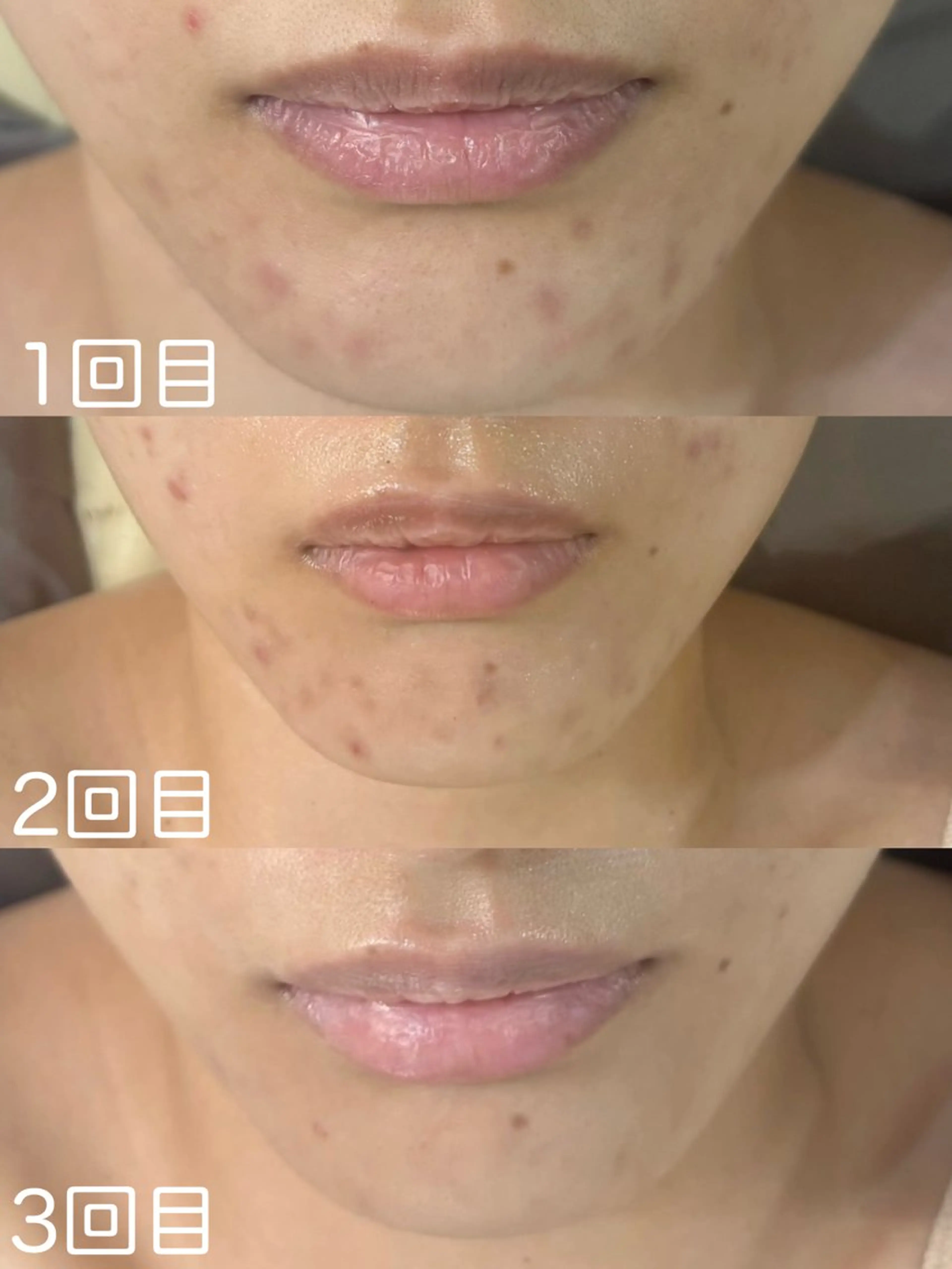 エステ WHITE AQUA 北千住店のエステ・リラクイメージ