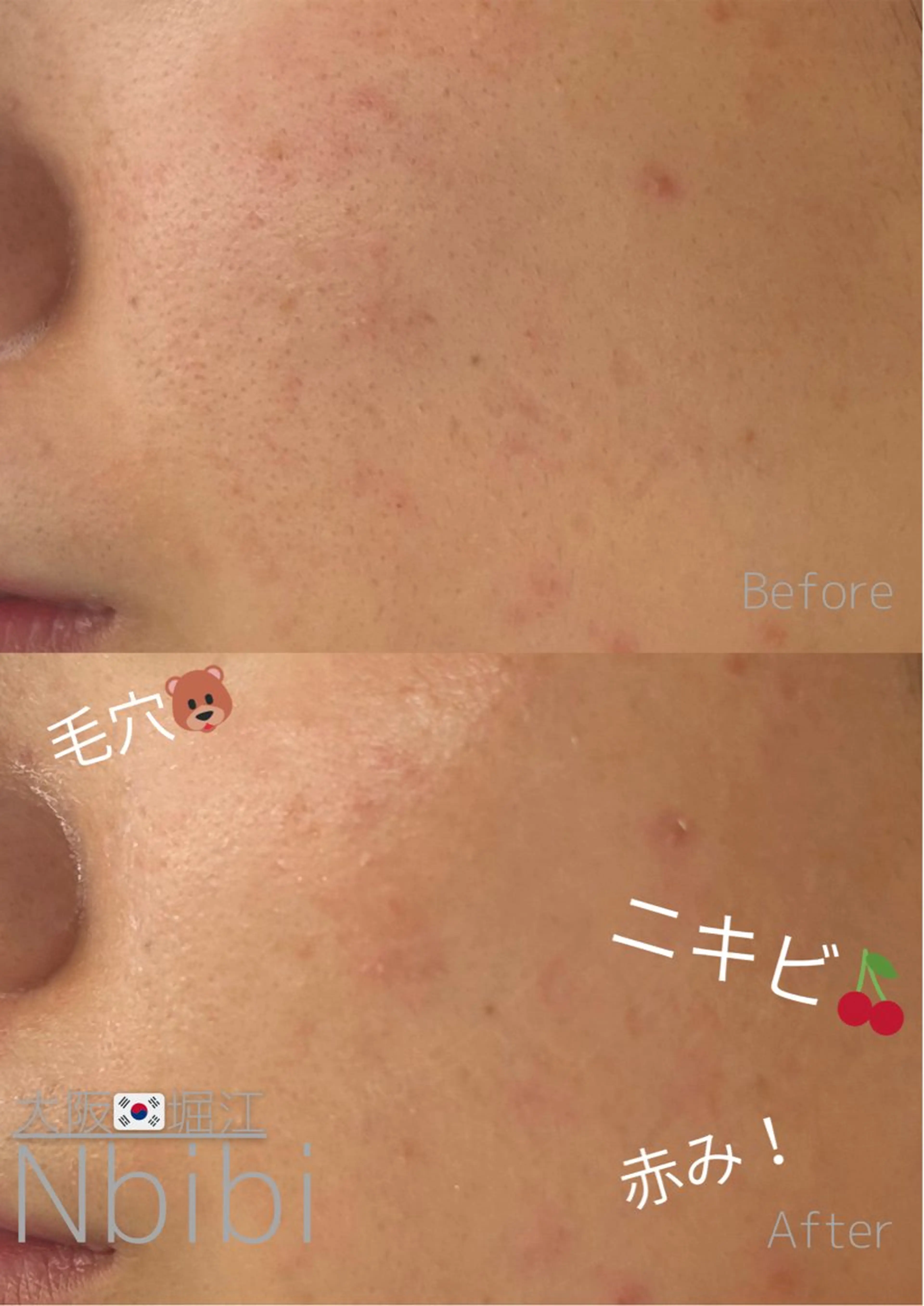 エステ 韓国🇰🇷価格 サロン_Nbibiのエステ・リラクイメージ