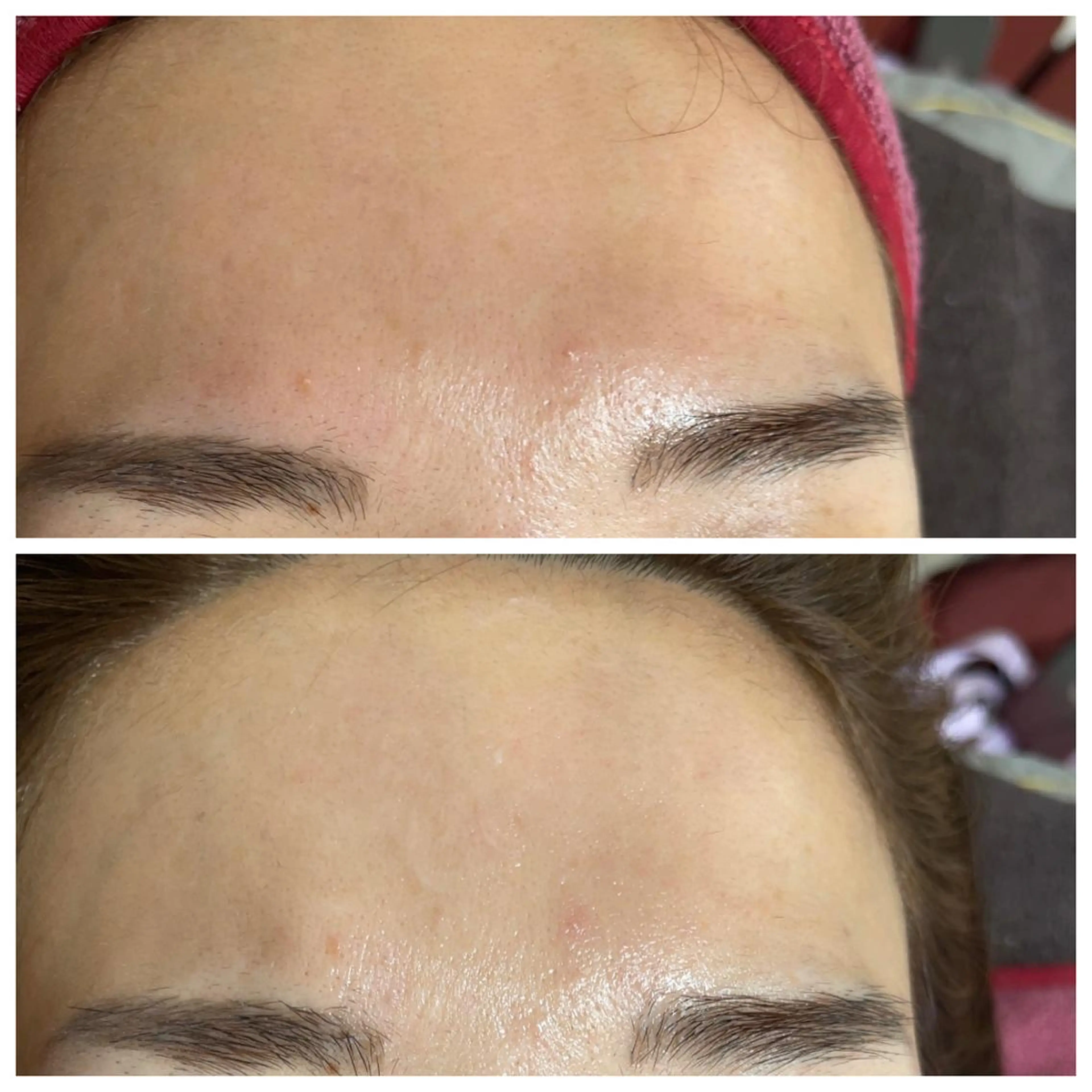 肌質改善サロン facialmoonのエステ・リラクイメージ