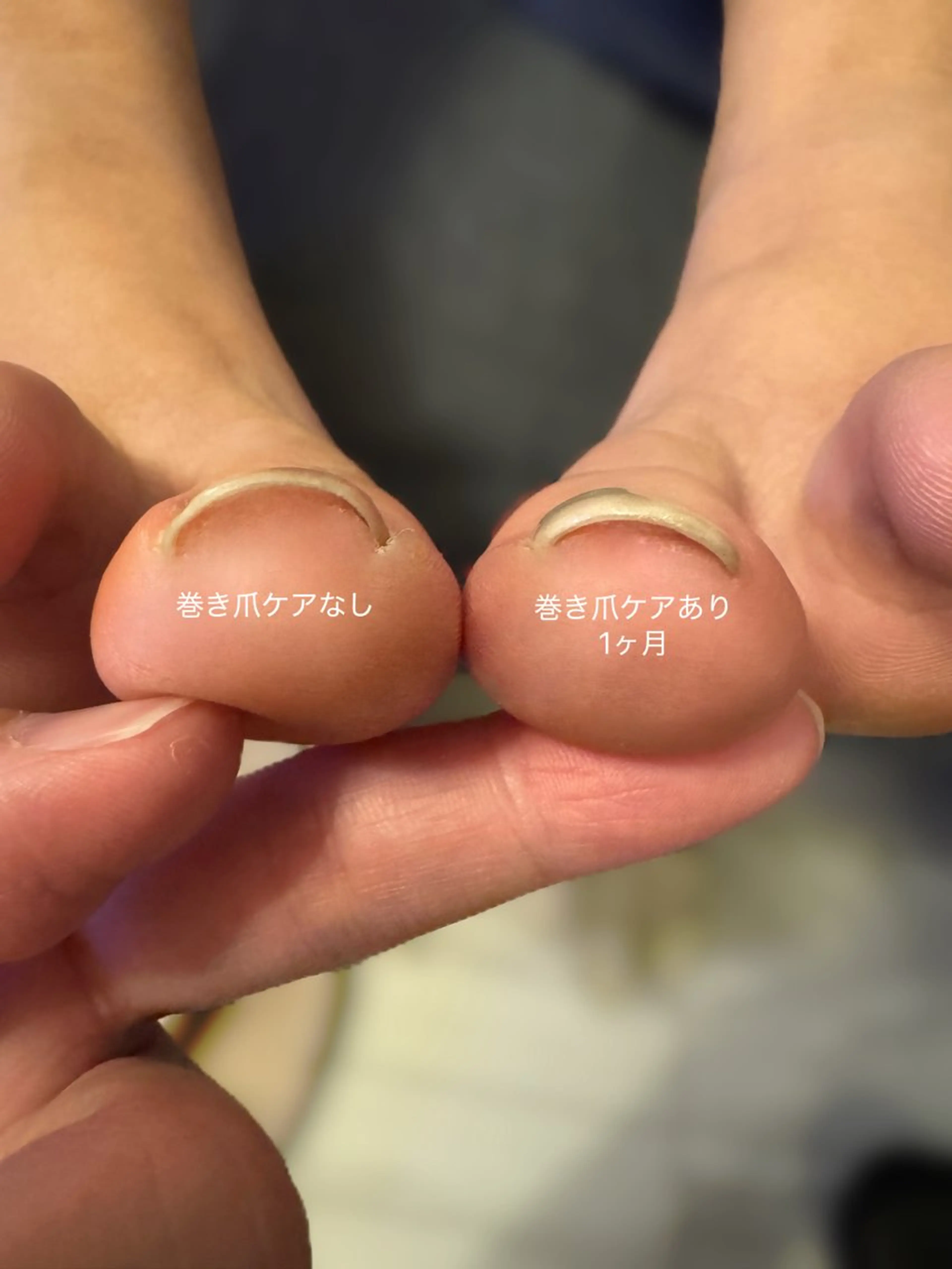 ネイル フットネイル ERINA ♥のネイルデザイン