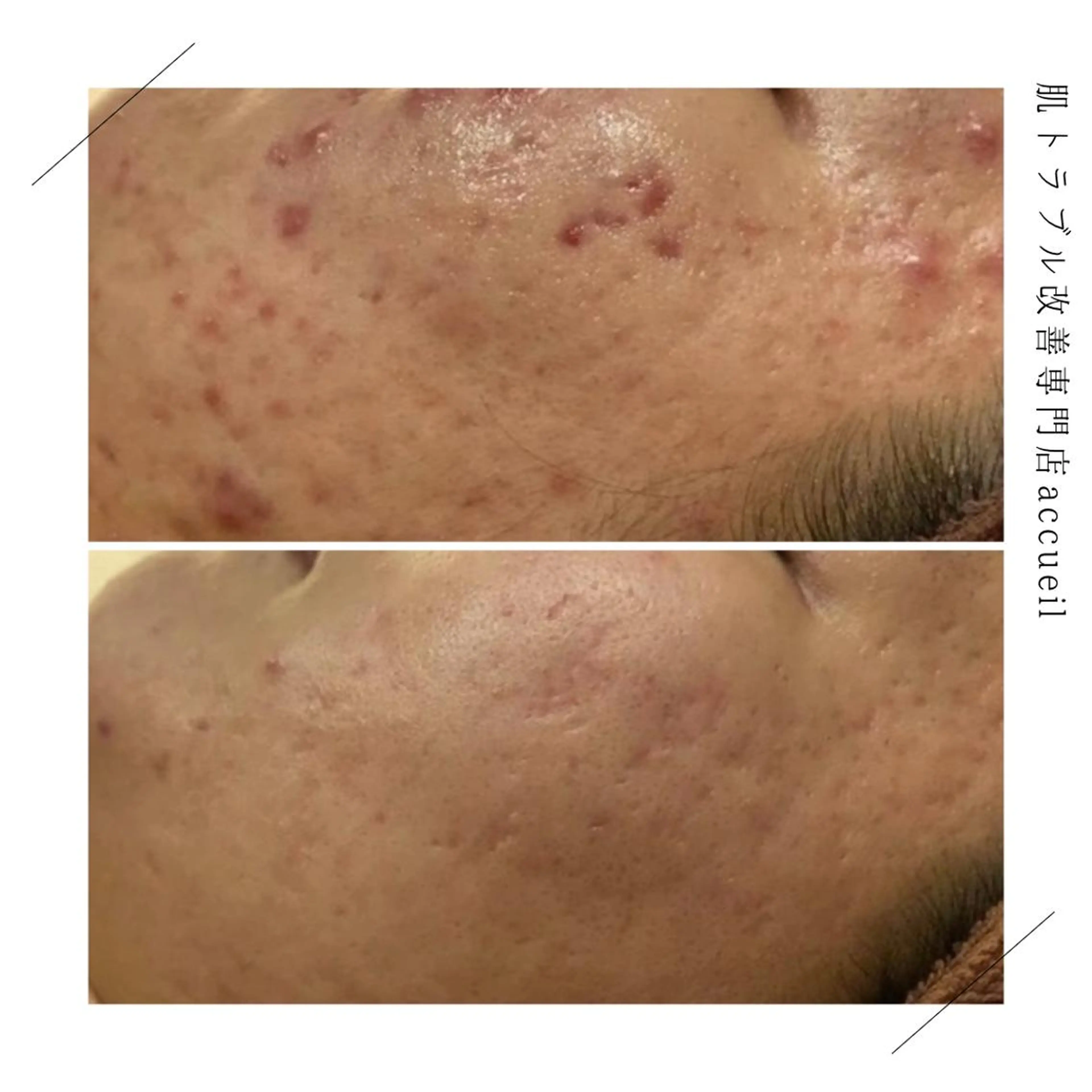 ロング カラー パーマ ヘアアレンジ メンズ キッズ ネイル マツエク・マツパ アイブロウ 触れたくなる モテ肌へ...❤︎のエステ・リラクイメージ