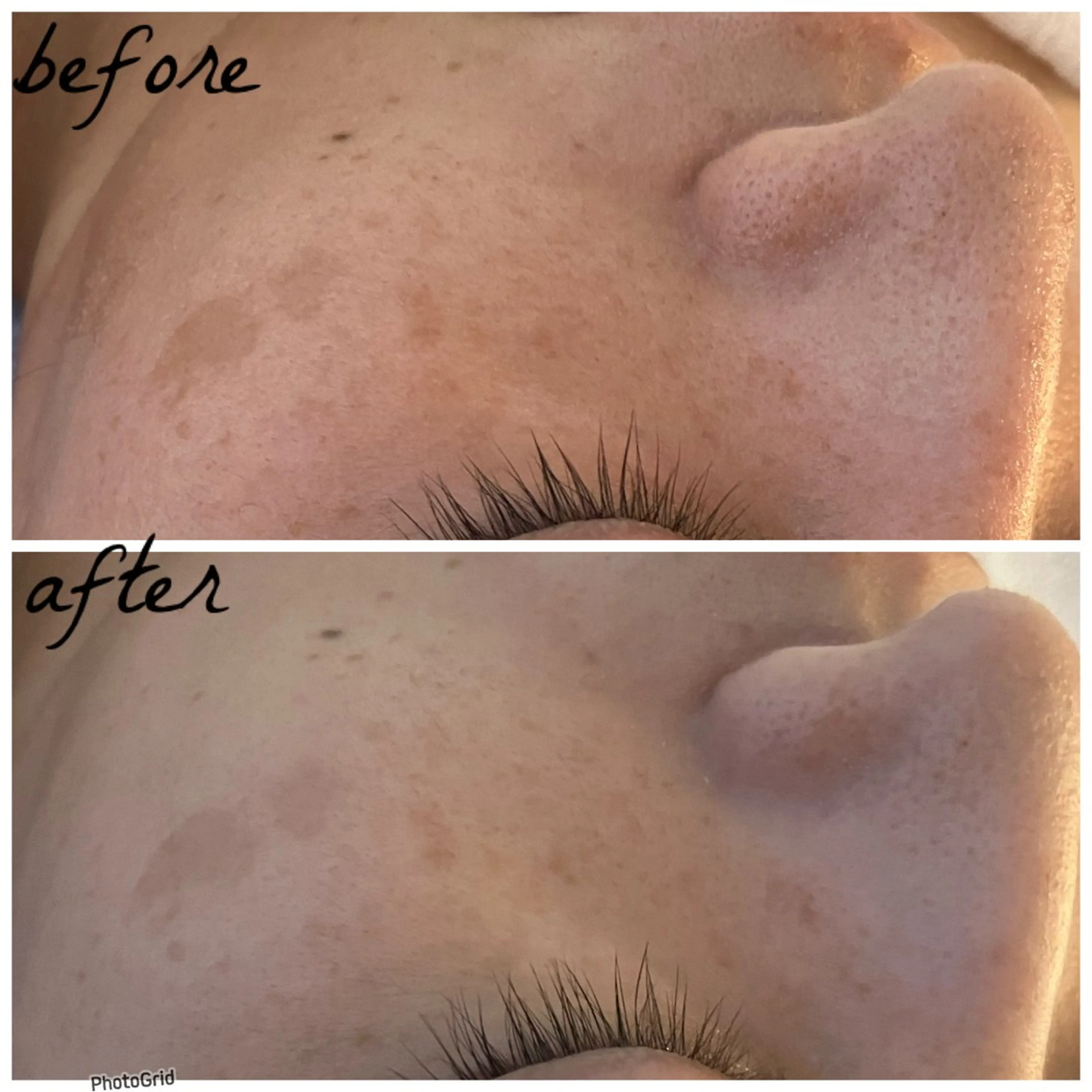 メンズ エステ メナード岐阜茜部 杉浦のエステ・リラクイメージ