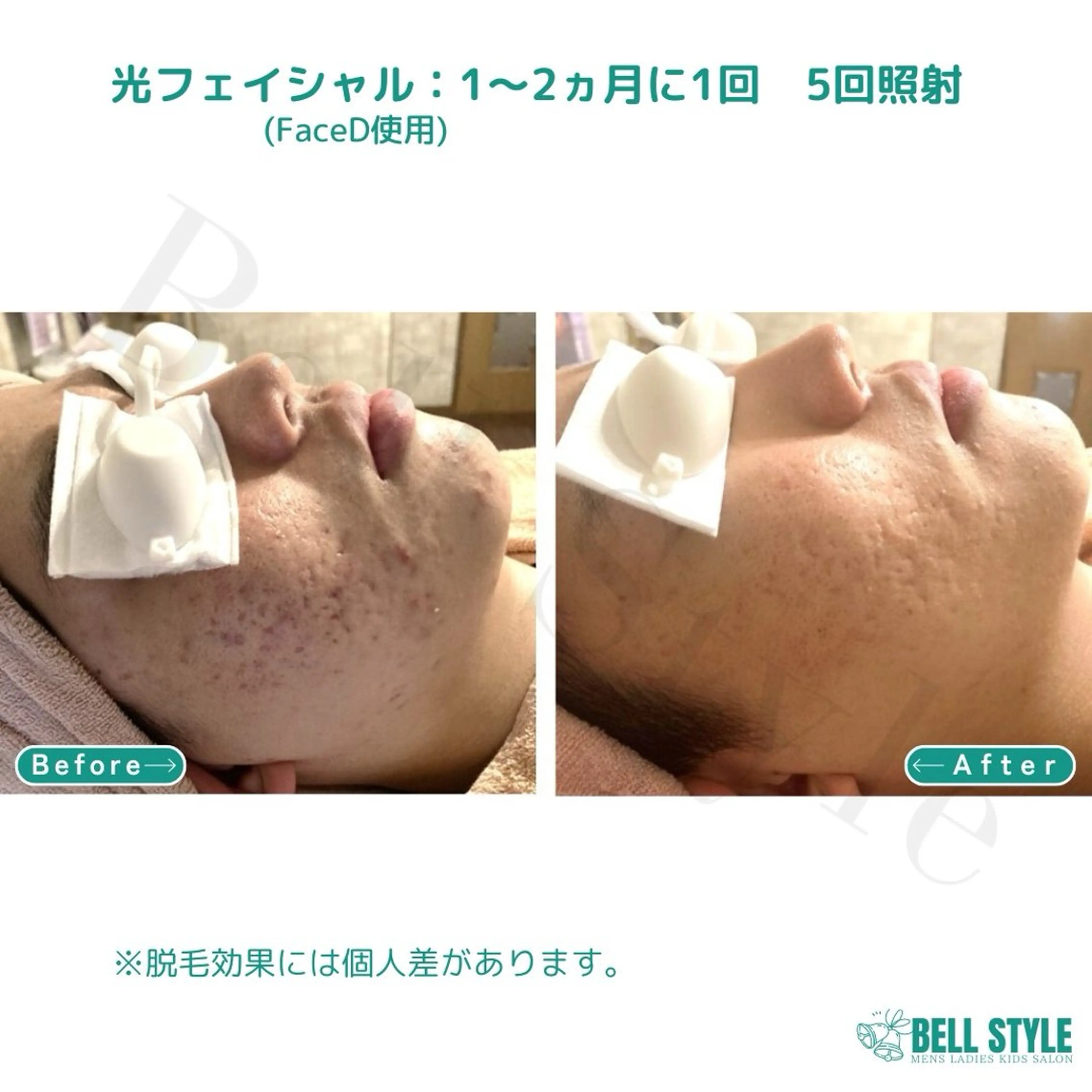 メンズ キッズ メンズ&レディース　Bell style所属・【脱毛・美肌専門】 bellstyleのエステ・リラクイメージ