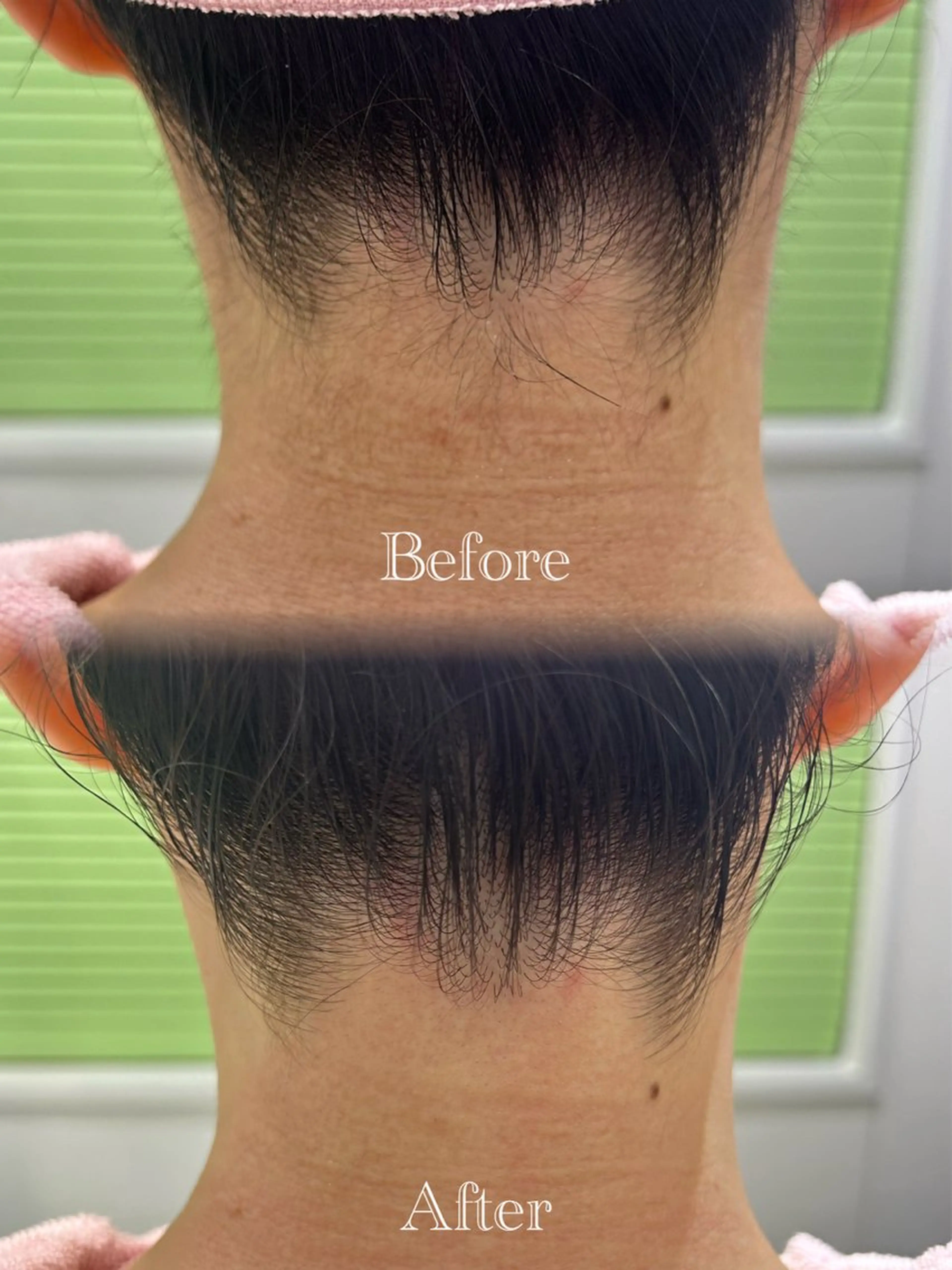 その他 🫧美しい素肌へ🫧 今成柚乃のその他イメージ