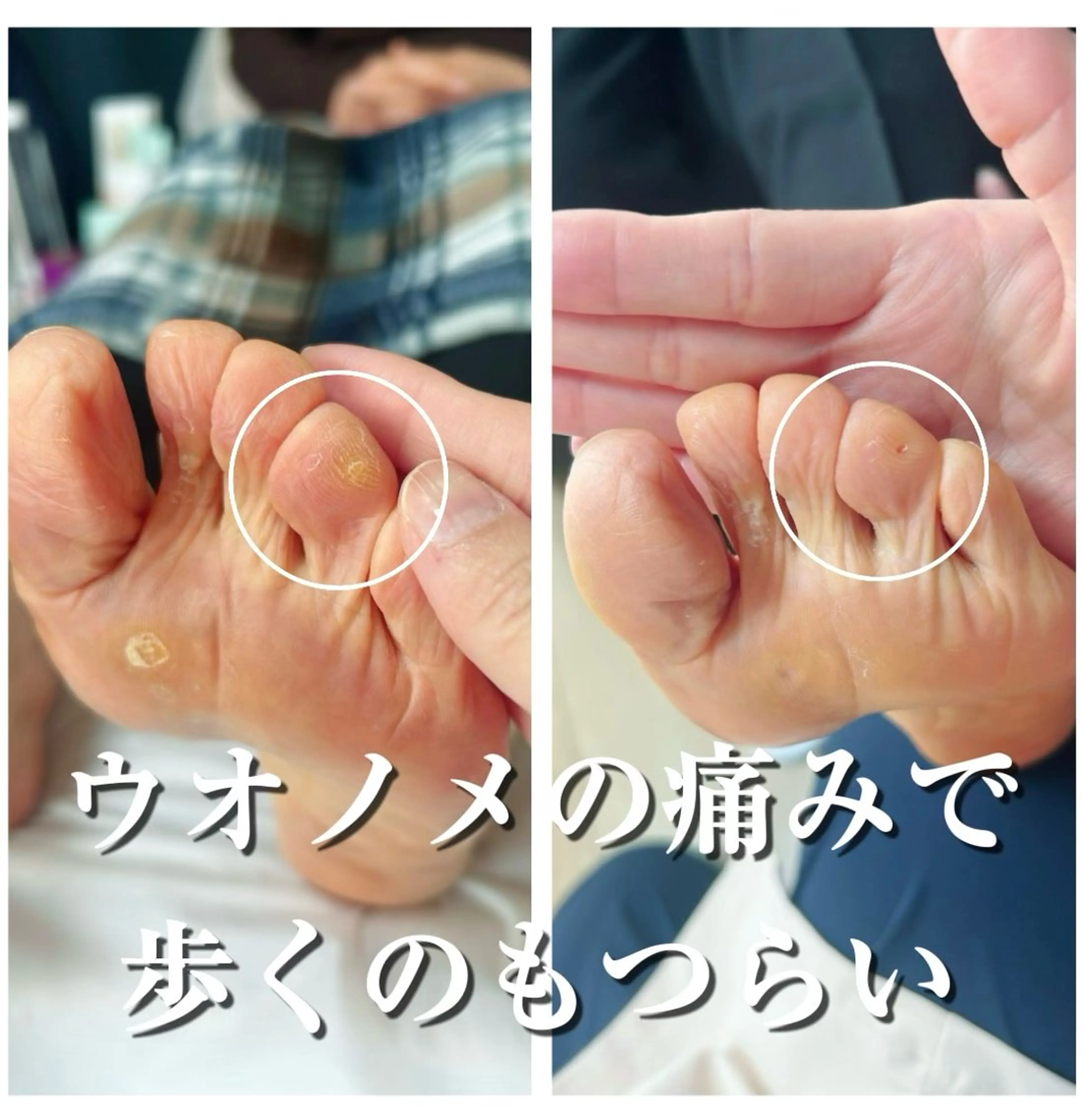 その他 巻き爪フットケアサロンKotori所属・フットケアサロン Kotoriのその他イメージ