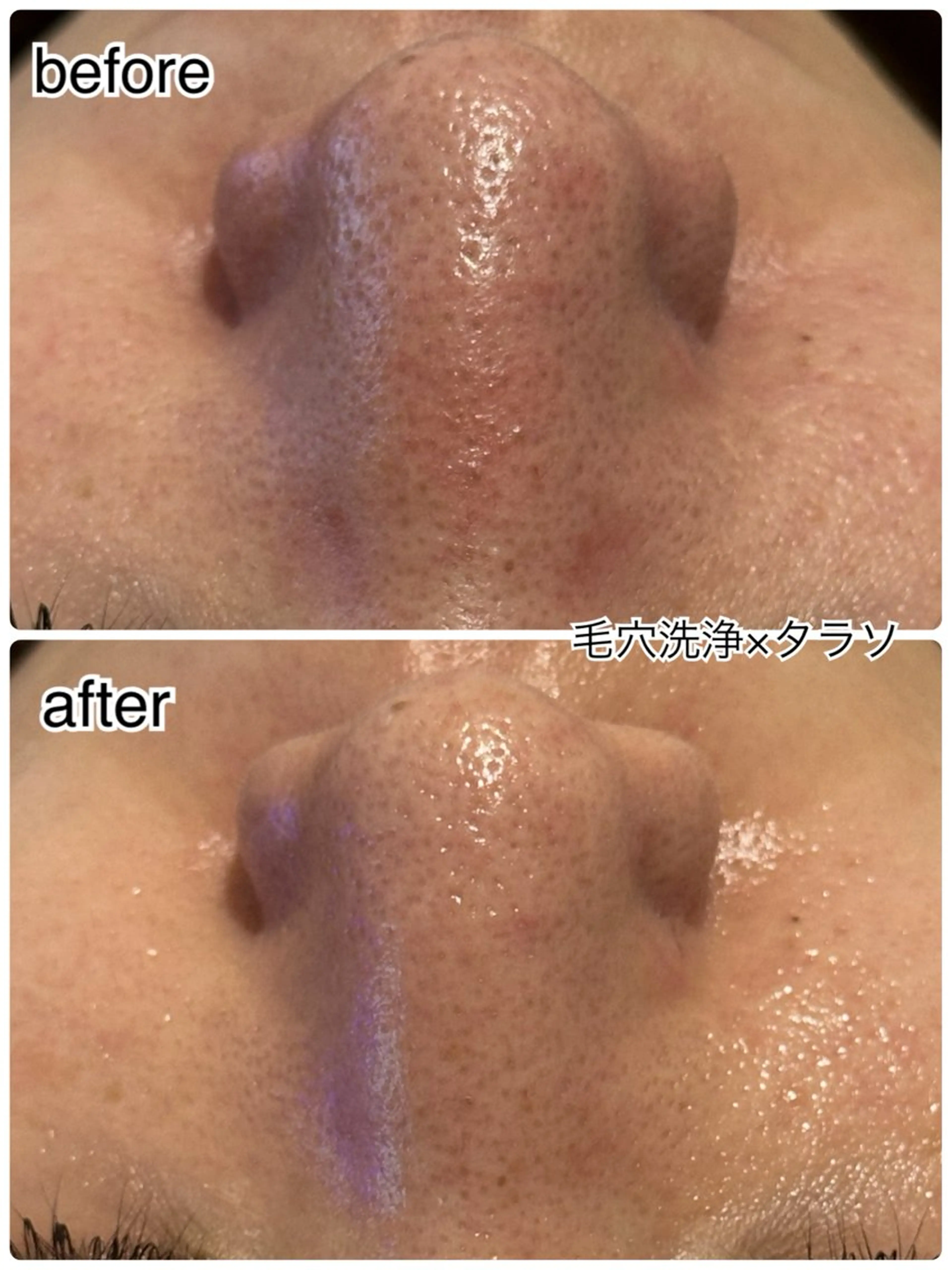 その他 ENCHANT 脱毛.小顔.毛穴のエステ・リラクイメージ