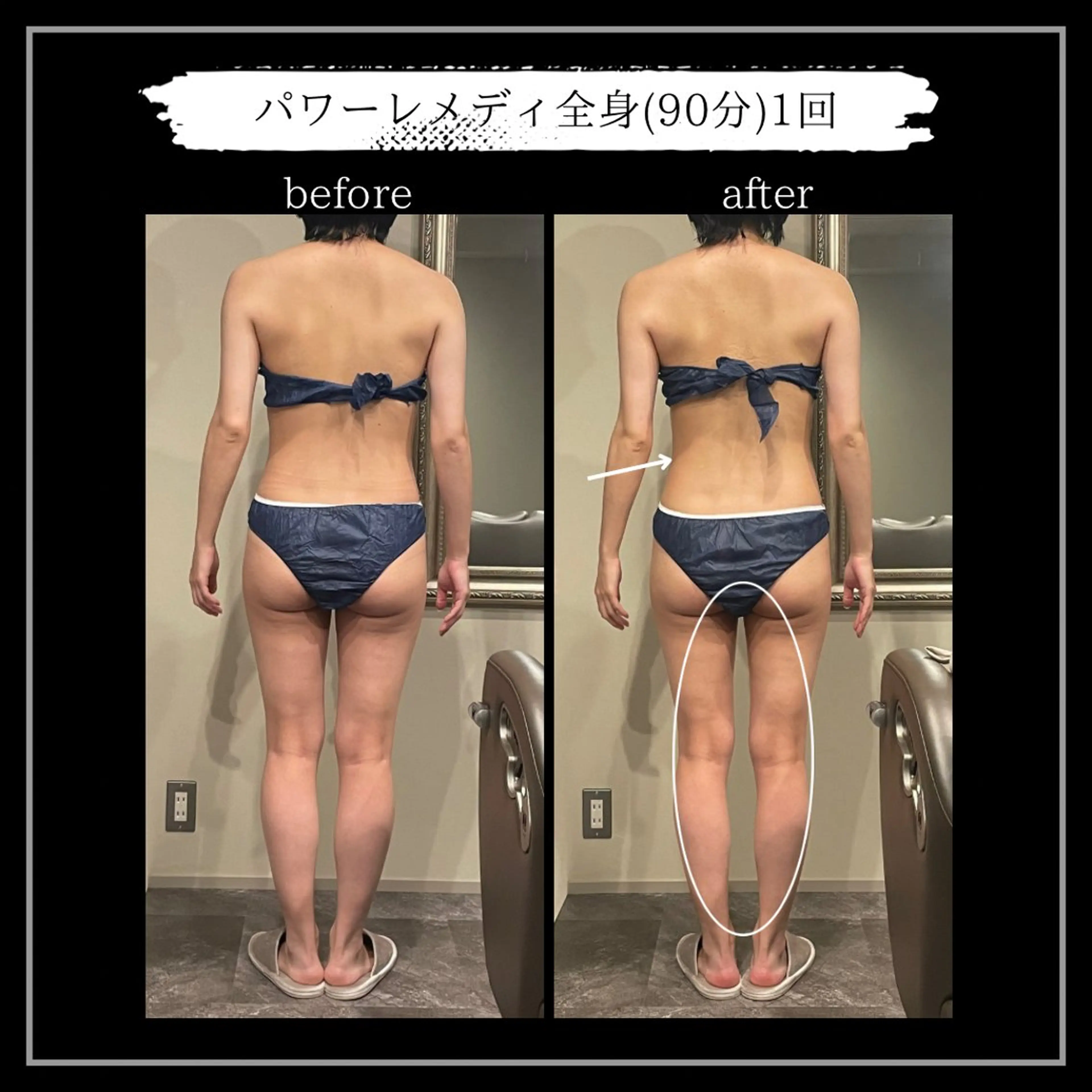 エステ リラク オフ:オン所属・オフ:オン 全身筋膜マッサージのエステ・リラクイメージ