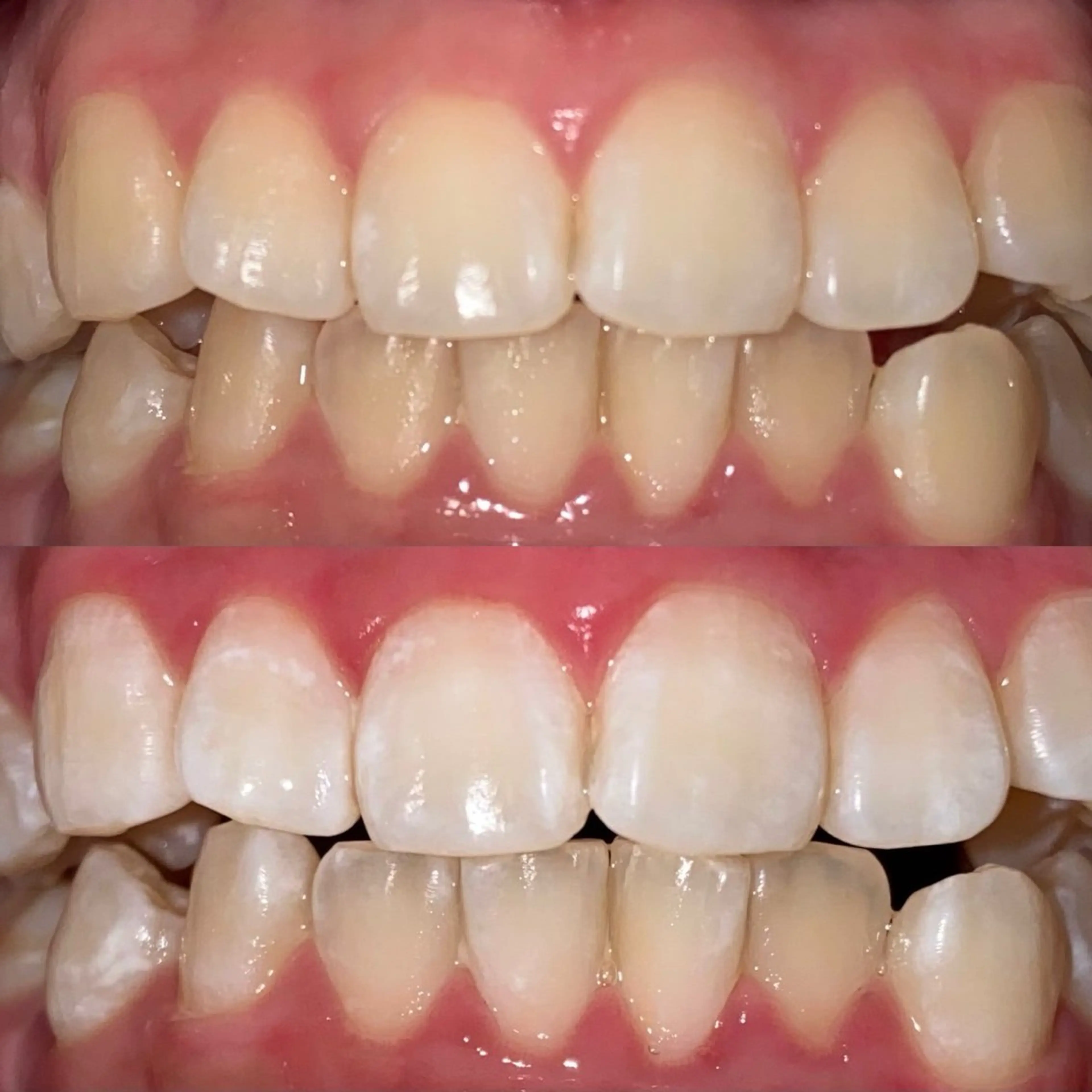 ホワイトニングサロンaile所属・セルフホワイトニング 金城しおりのその他イメージ