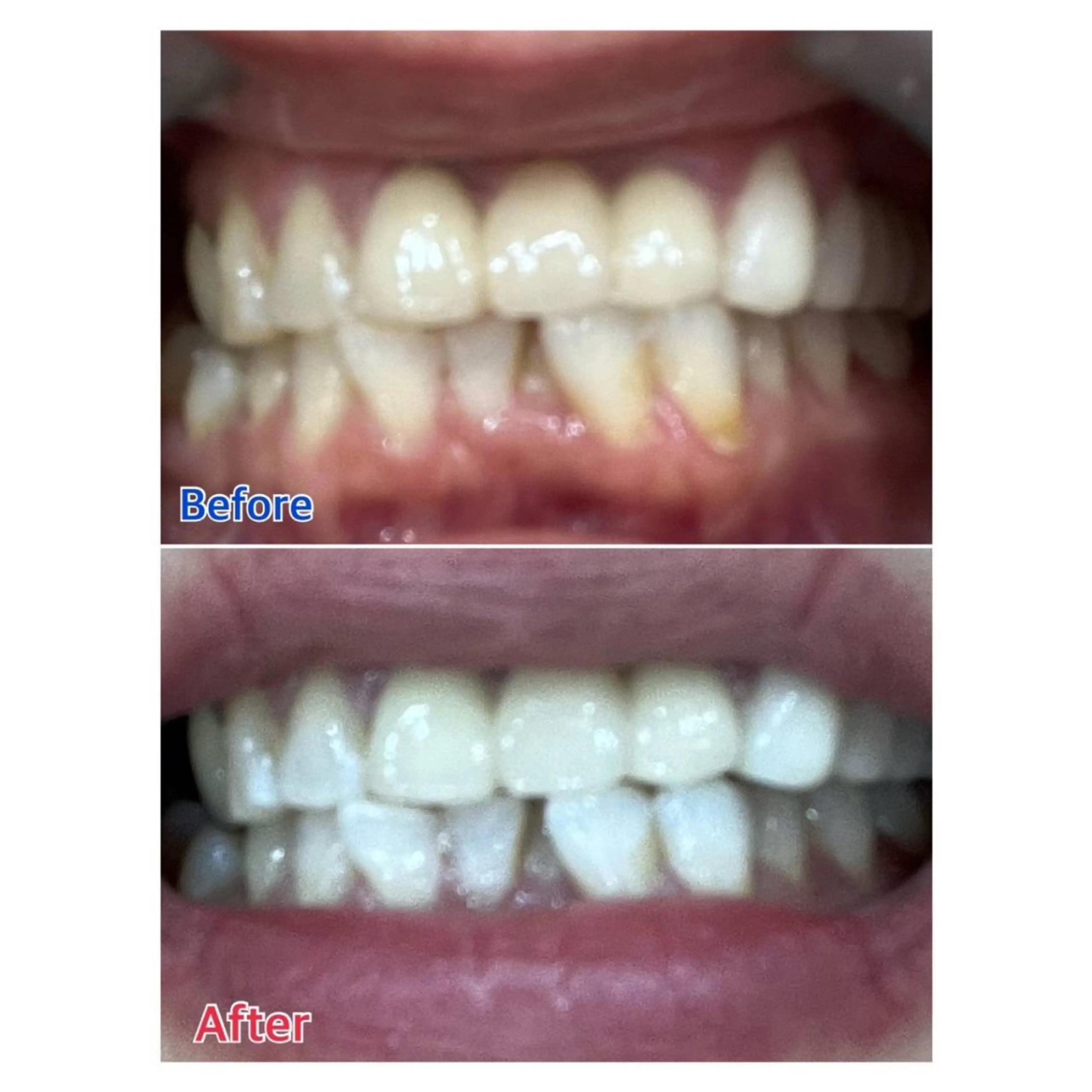 MBEAUTYSALON 千葉店・京成大久保所属・Melty 輝のその他イメージ