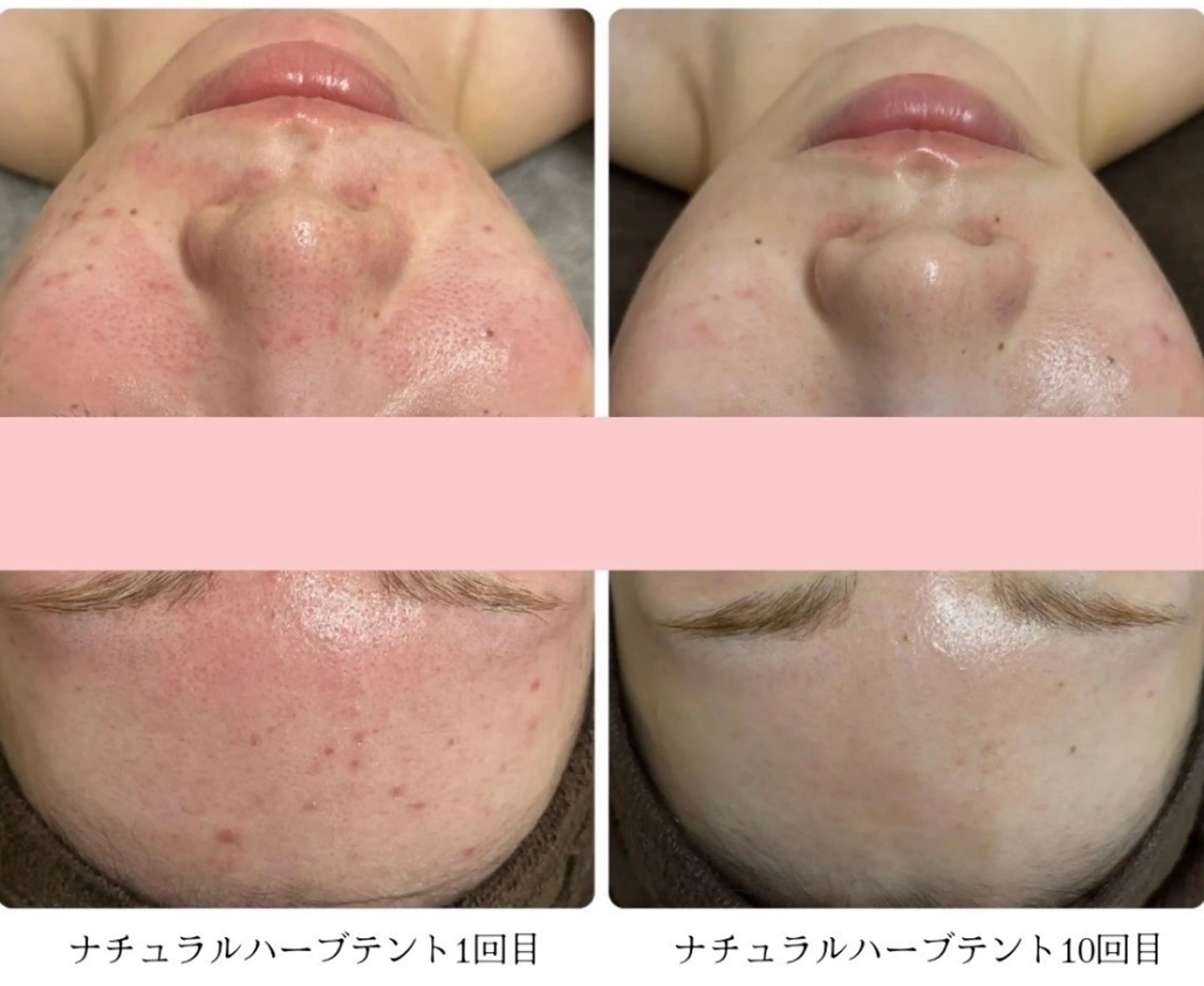 エステ リラク ハーブ蒸しサロン🌿 香嬉琉🌿きよかのエステ・リラクイメージ