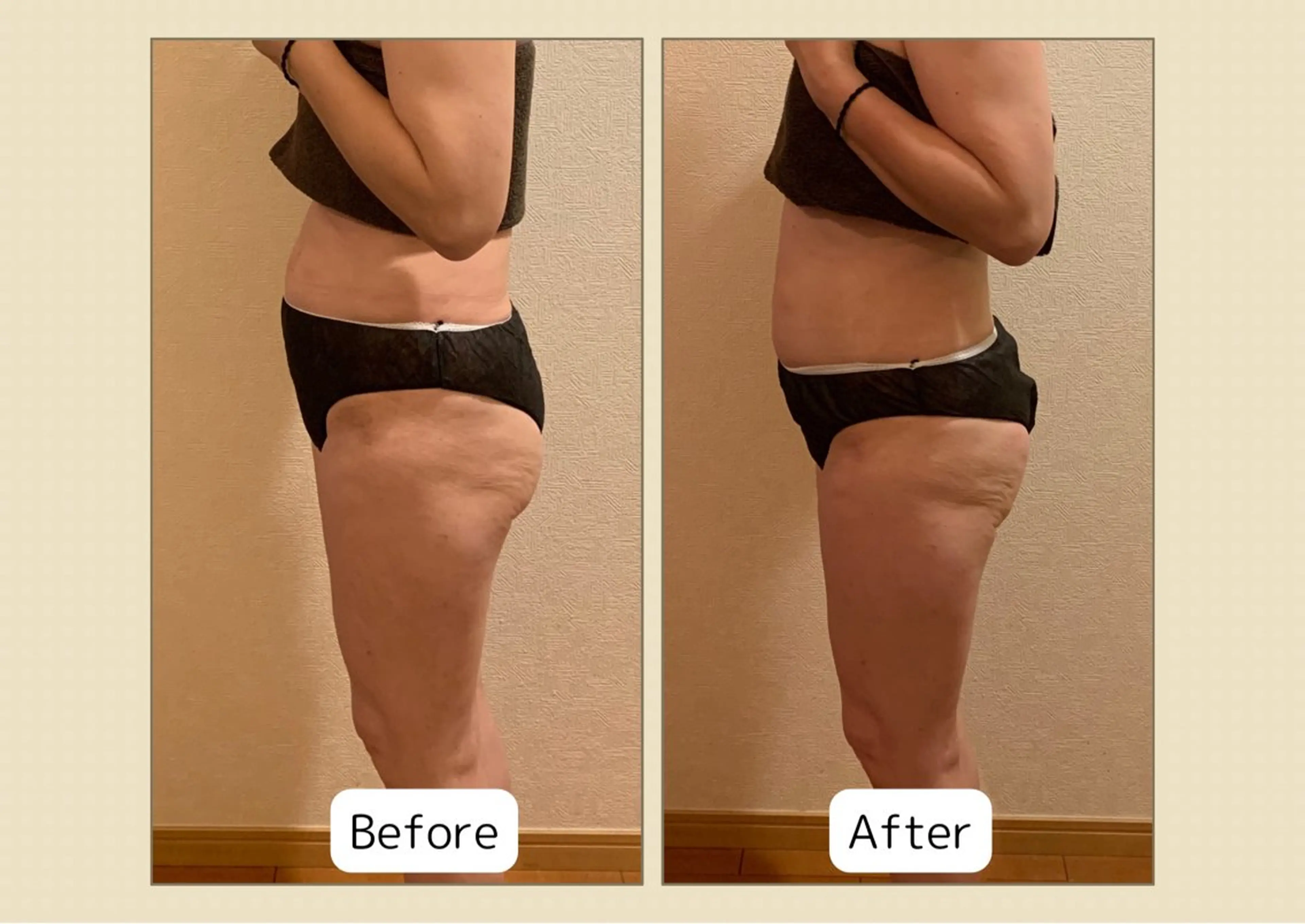 【人気No.1】最先端よもぎ蒸し＋痩身小顔美肌ケア90分¥13,800→¥7,800の写真